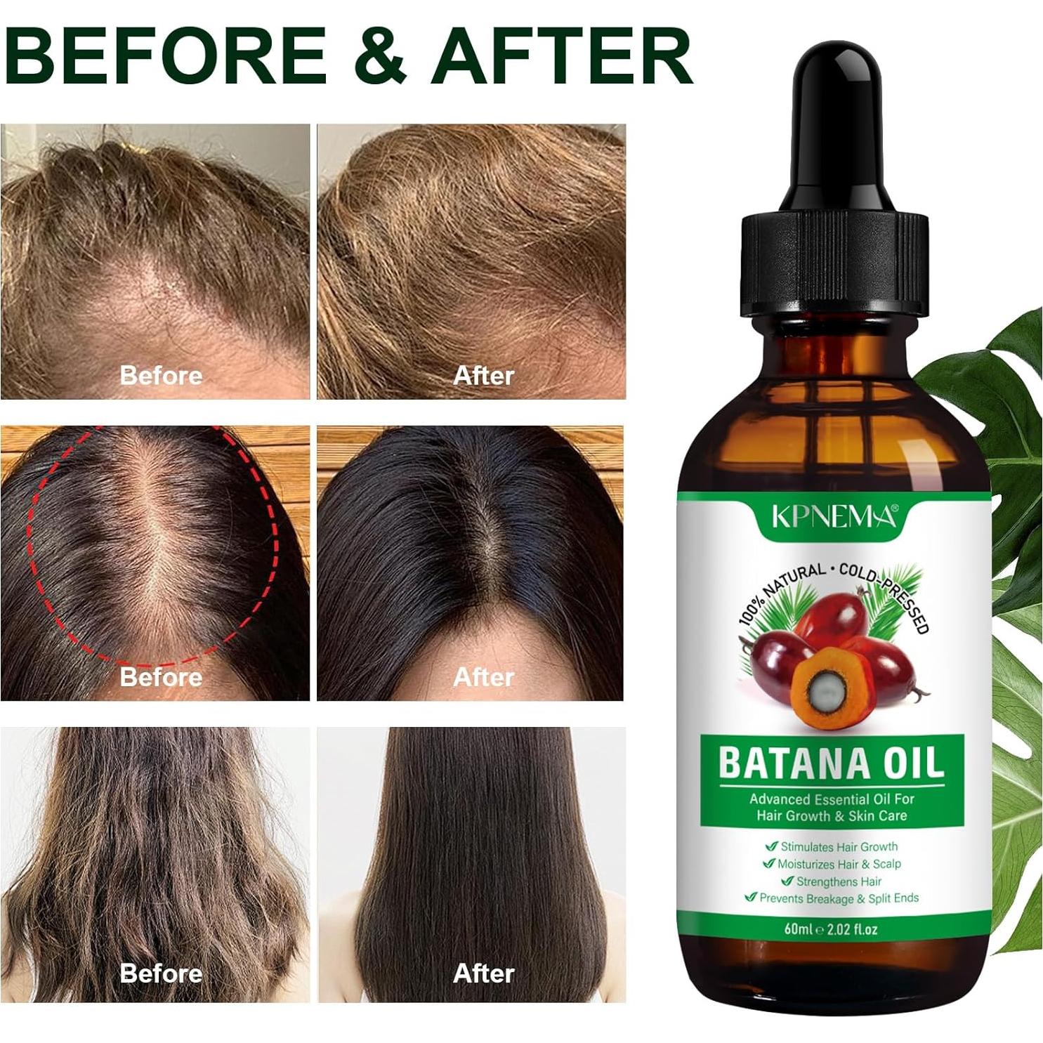 Aceite de Batana Kpnema 2x59.87ml Hidratante Cabello y Piel