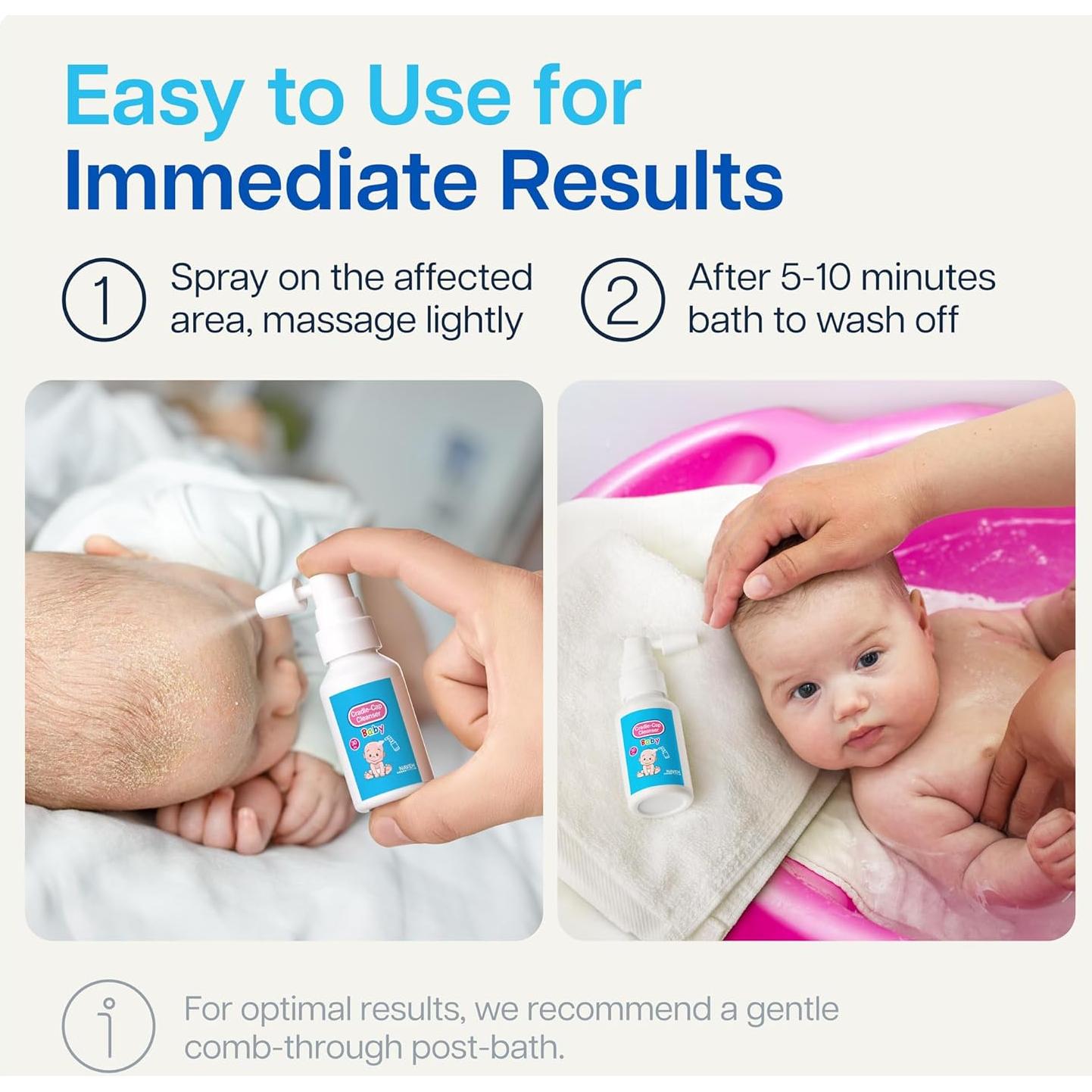 Limpiador de Costra Láctea Natural Naveh Pharma 29.57 ML