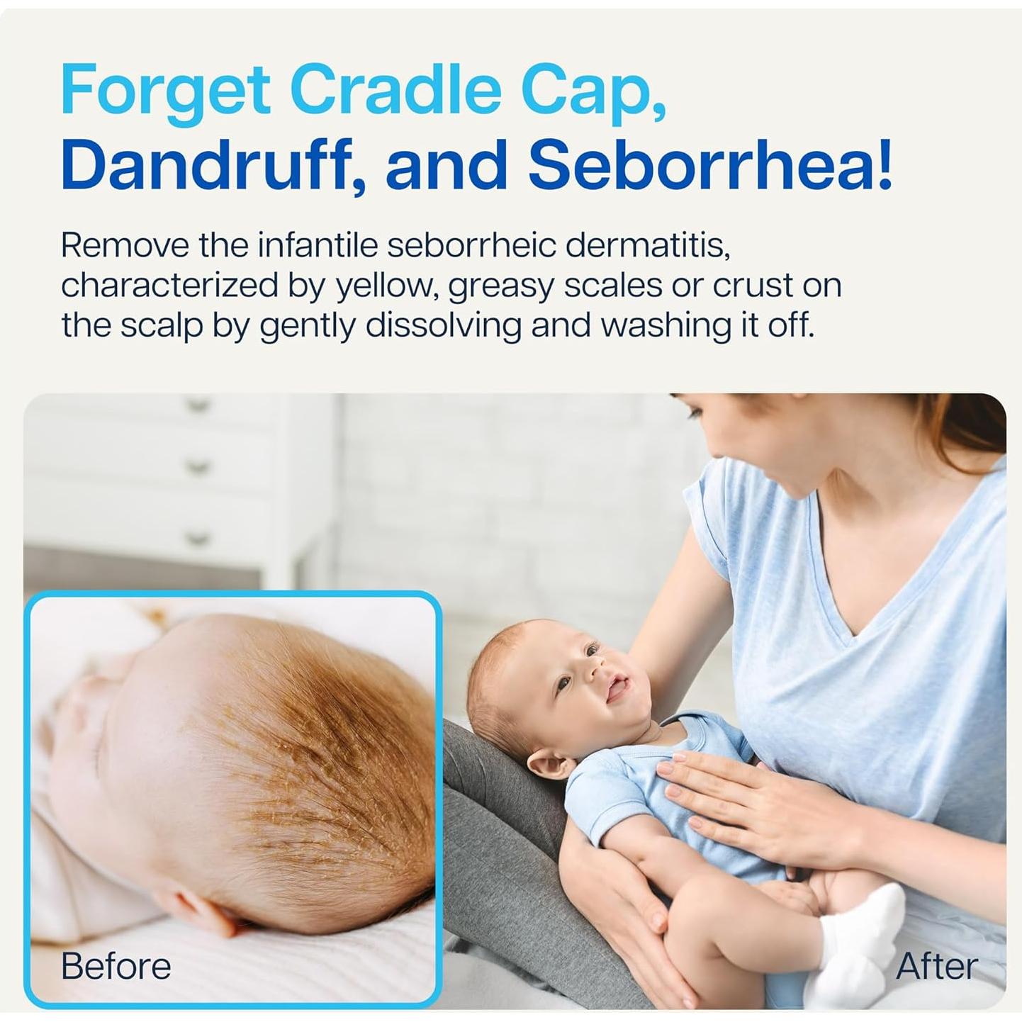 Limpiador de Costra Láctea Natural Naveh Pharma 29.57 ML