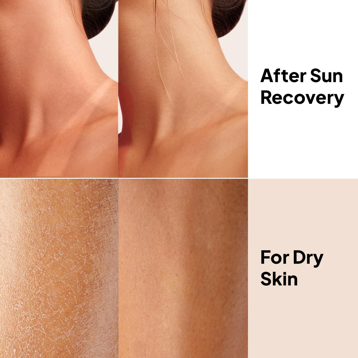 Gel de Aloe Vera Orgánico Hija de CoBa 300g - Alivio Quemaduras Solares