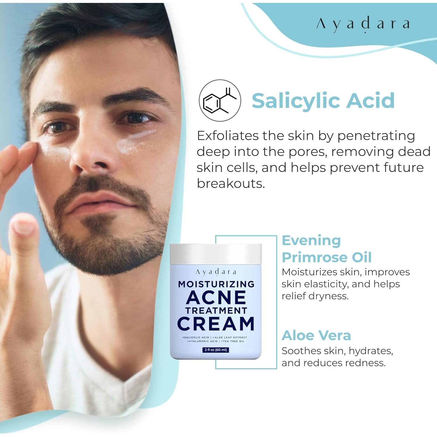 Crema Hidratante Facial Acné Ayadara 90g - Ácido Salicílico