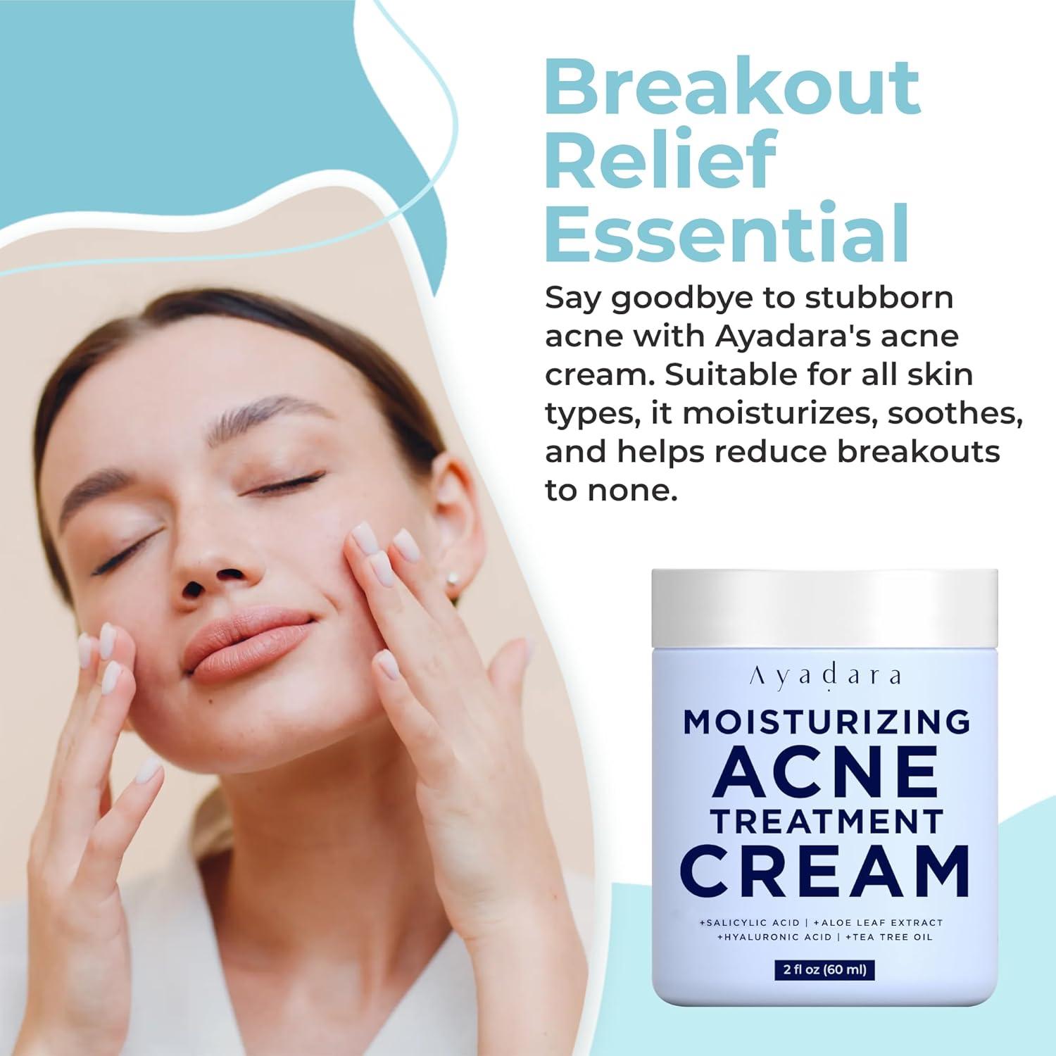 Crema Hidratante Facial Acné Ayadara 90g - Ácido Salicílico