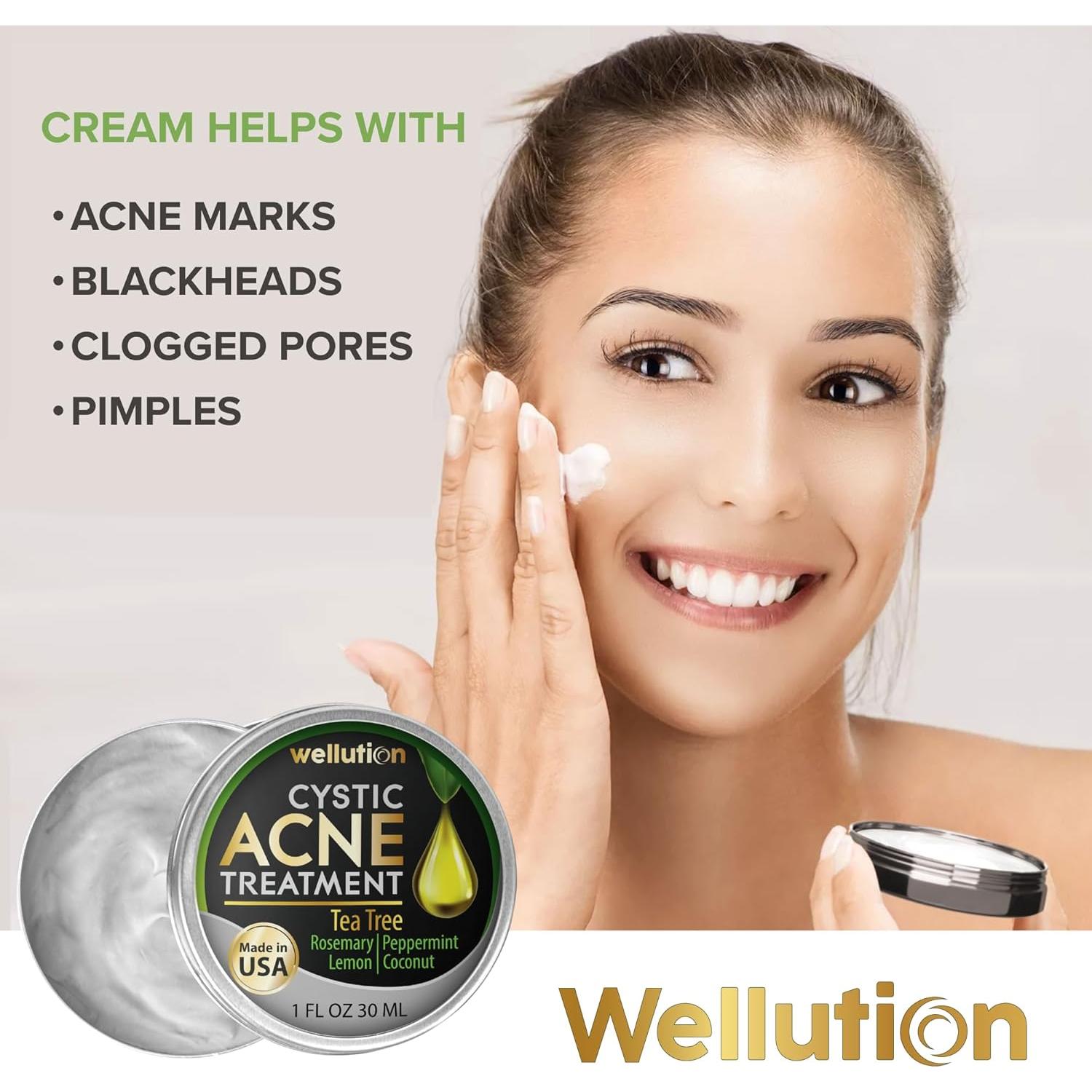 Tratamiento Natural para Manchas de Acné Quístico Wellution 28g