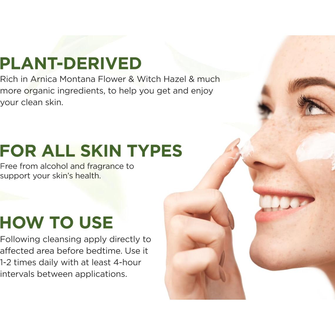 Tratamiento Natural para Manchas de Acné Quístico Wellution 28g