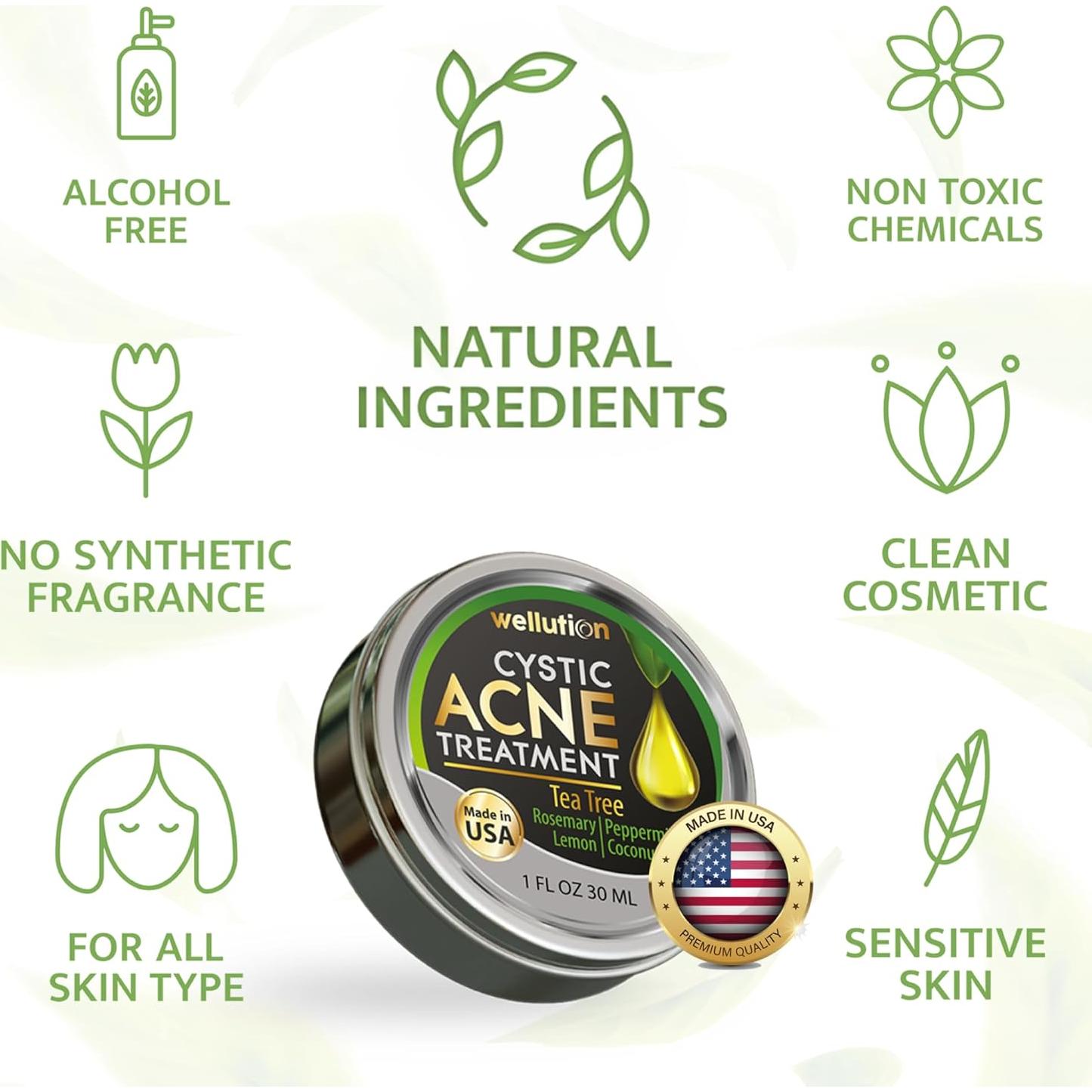 Tratamiento Natural para Manchas de Acné Quístico Wellution 28g