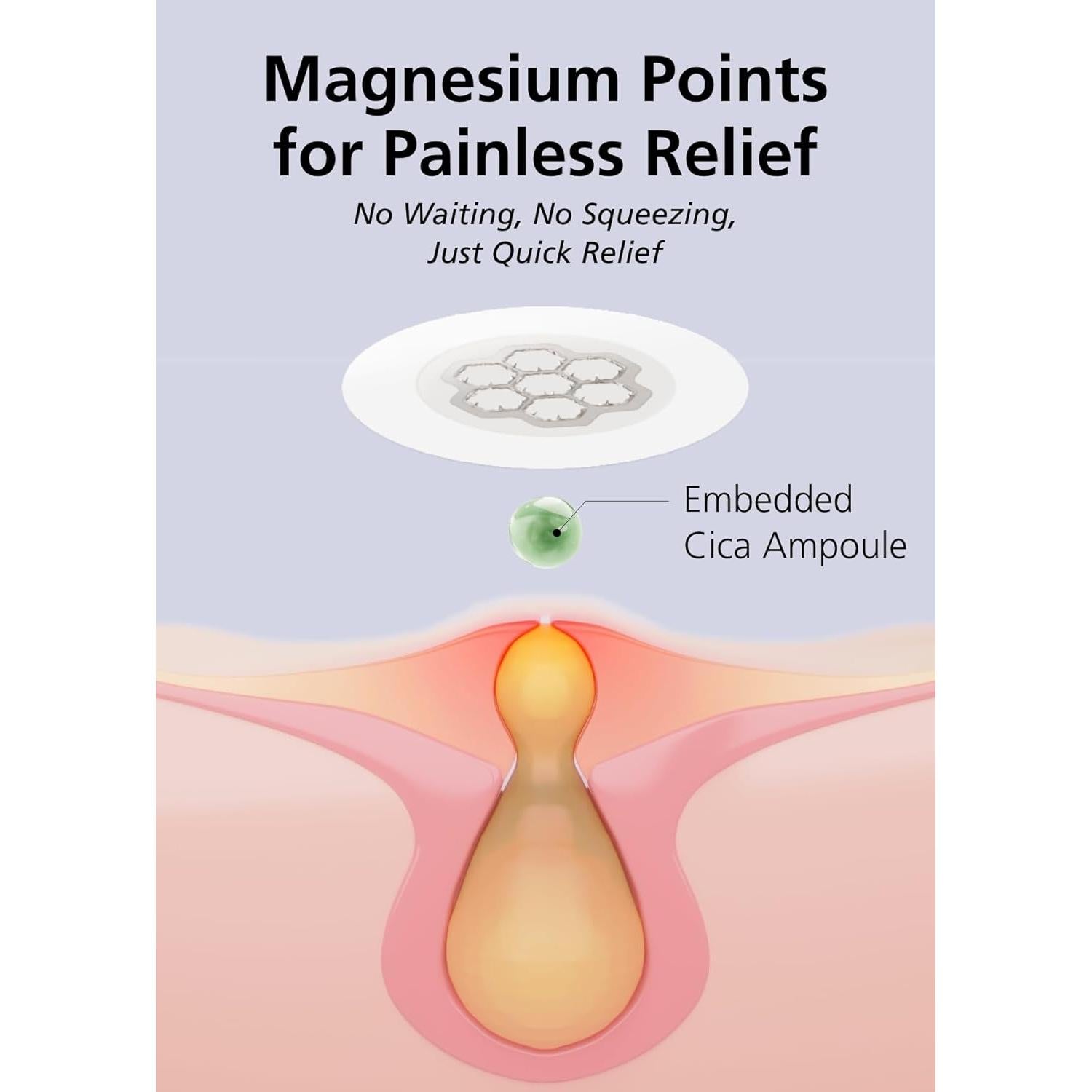 Parches Calmantes de Magnesio EasyDerm - 10 Parches Hidrocoloide