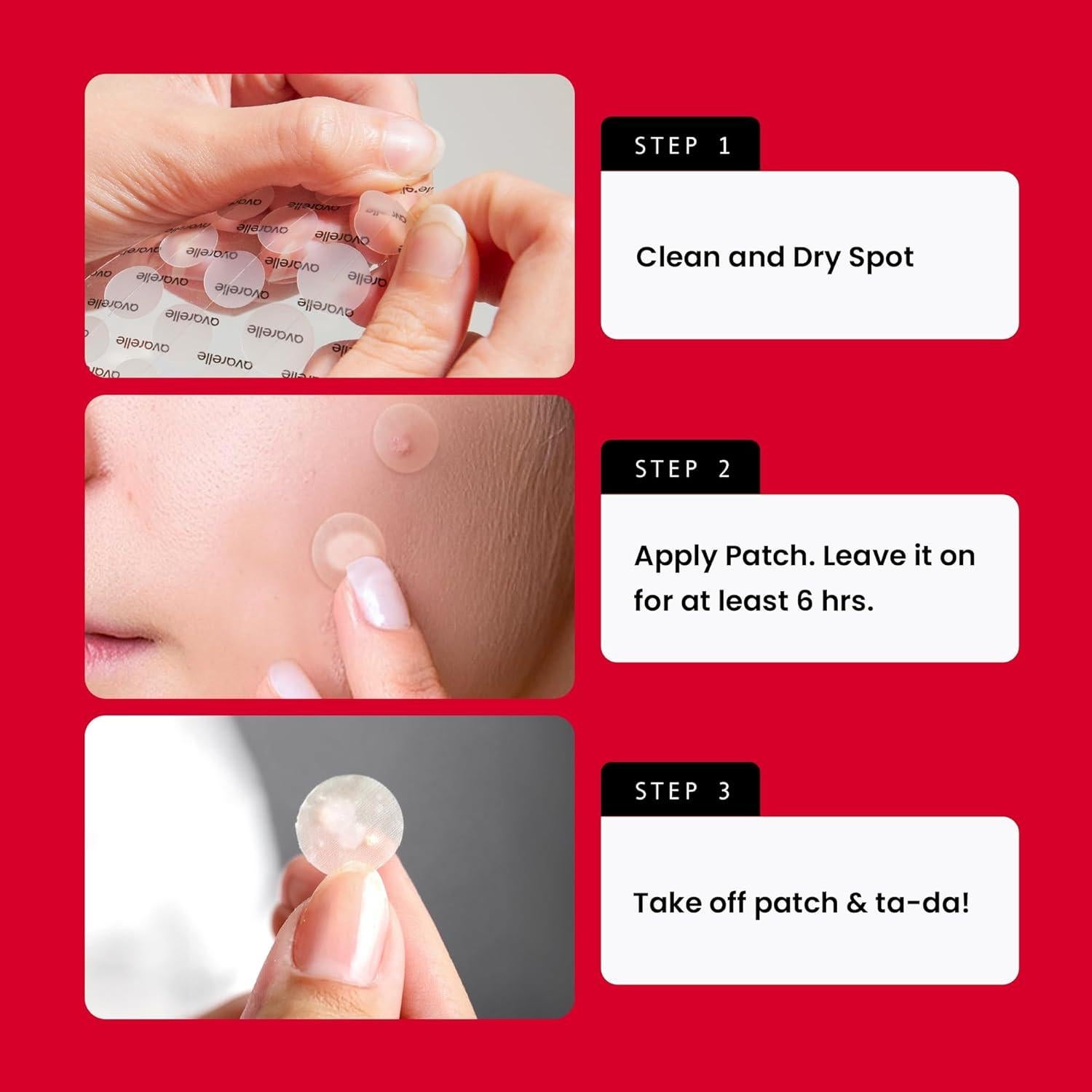 Parche Hidrocoloide para Acné Avarelle - 40 Unidades Vegano