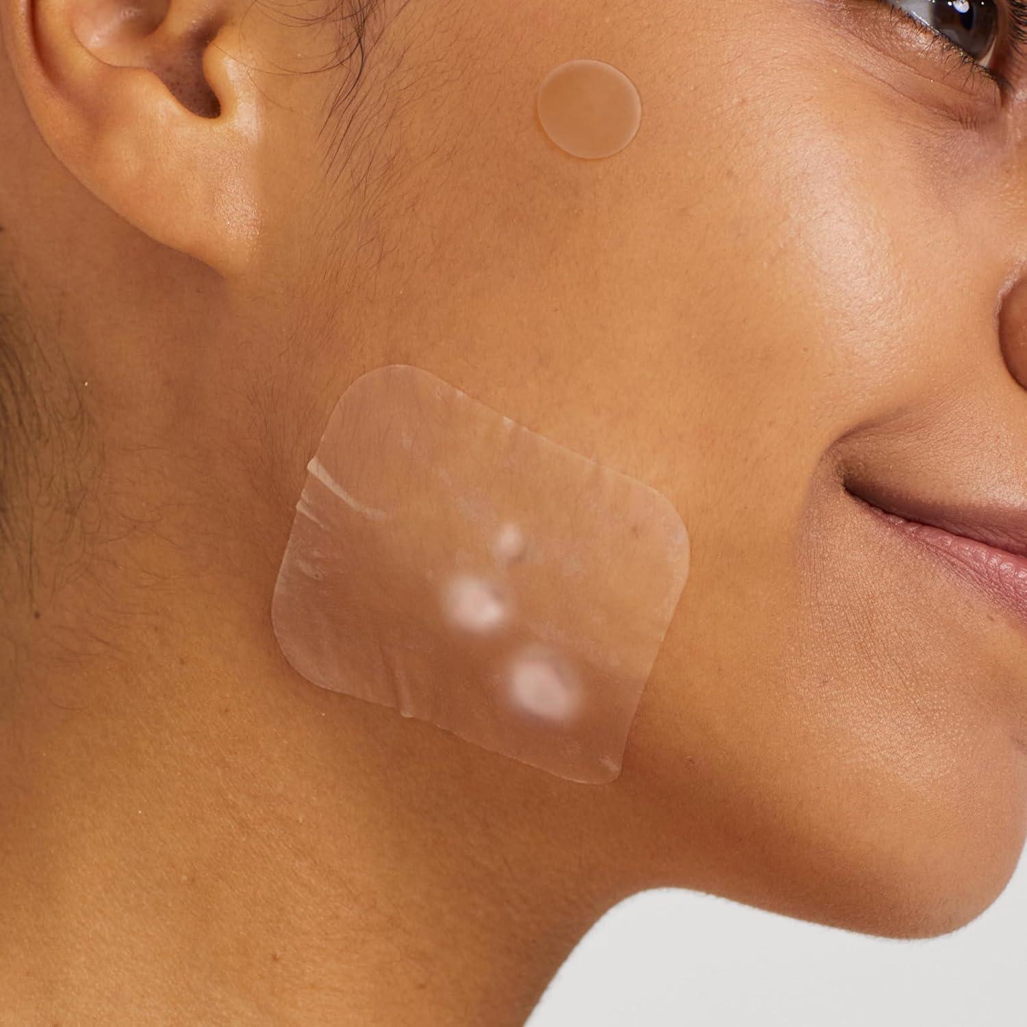 Parche Hidrocoloide para Acné Avarelle - 40 Unidades Vegano