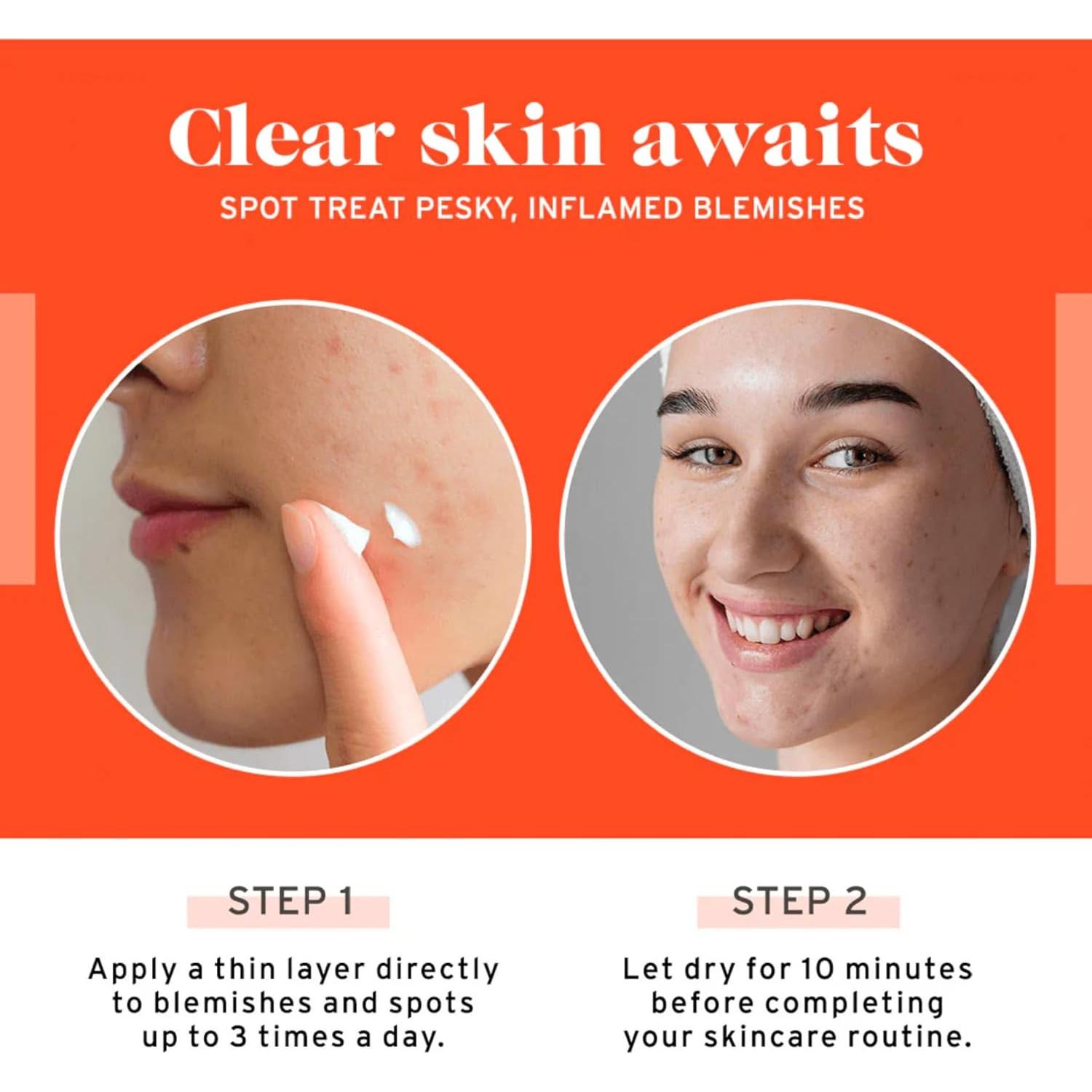 Tratamiento para Manchas de Acné No Bad Stuff 14 g - 2% Ácido Salicílico