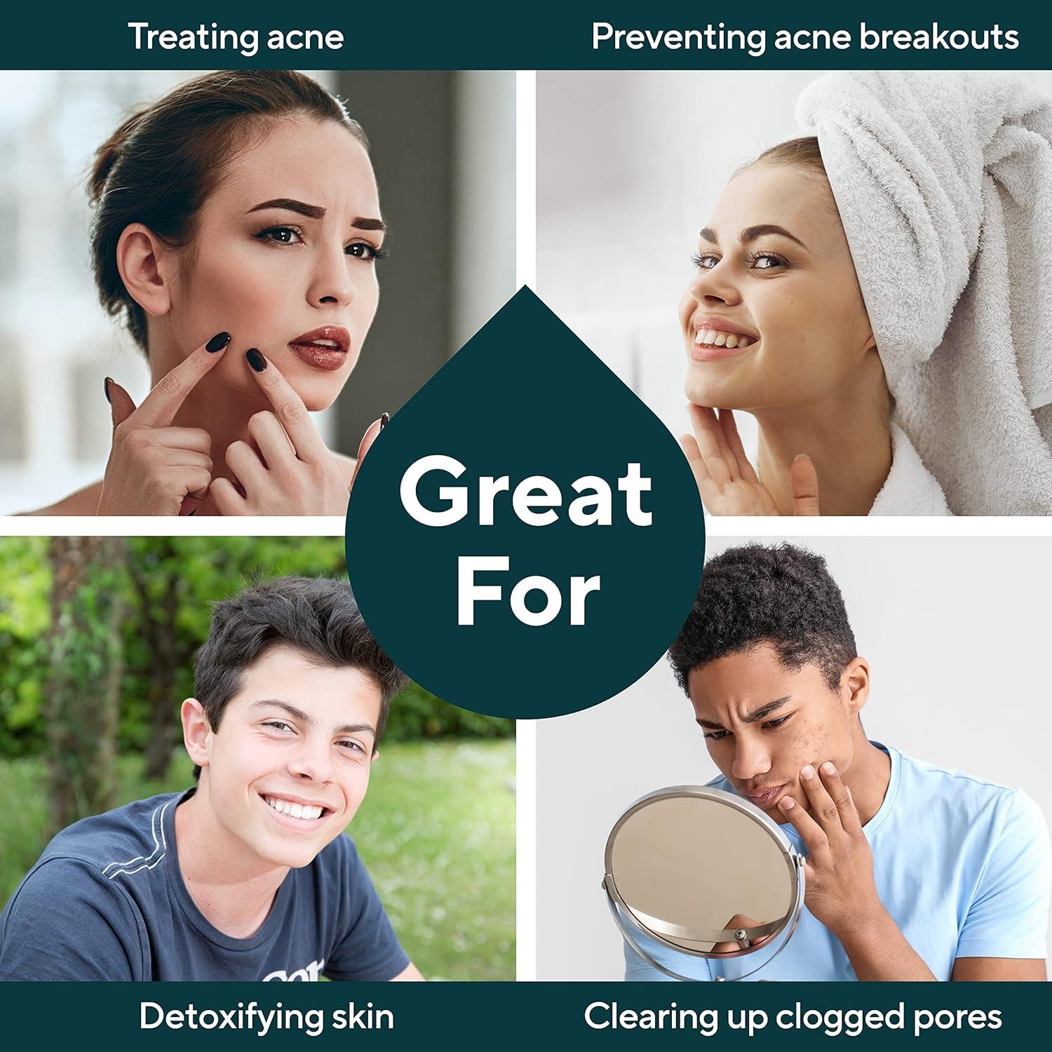 Jabón Natural para Acné Marie's Original con Arcilla y Avena 82g