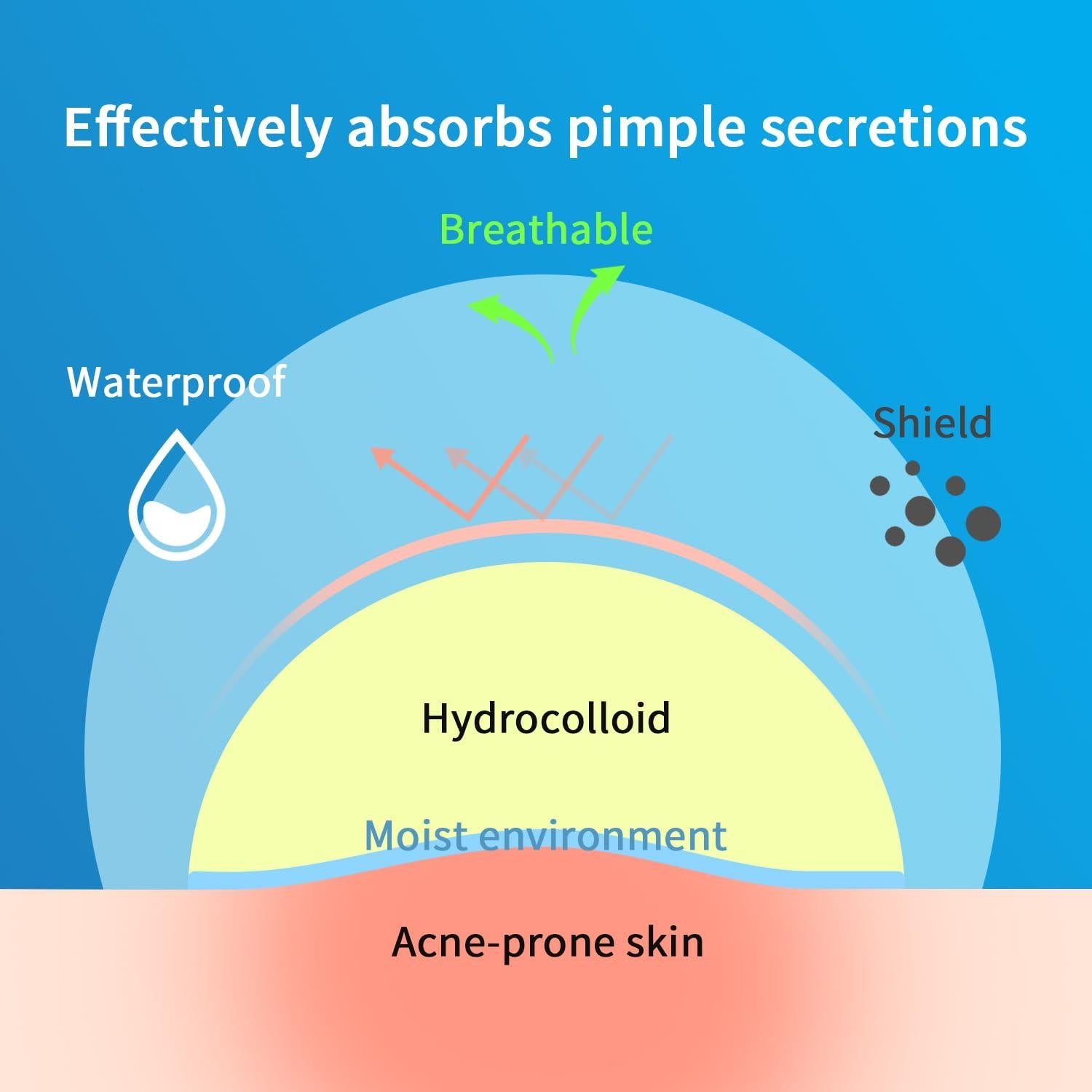 Parches para Granos Hidrocoloides GOESTRIC 216 Unidades