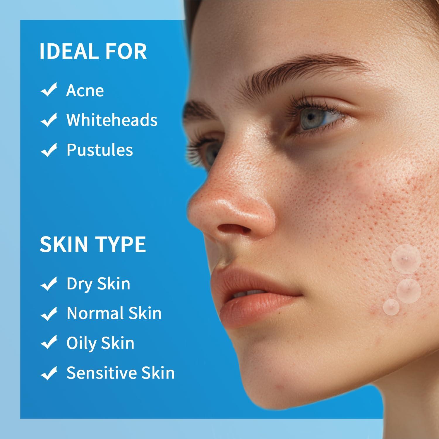 Parches para Granos Hidrocoloides GOESTRIC 216 Unidades