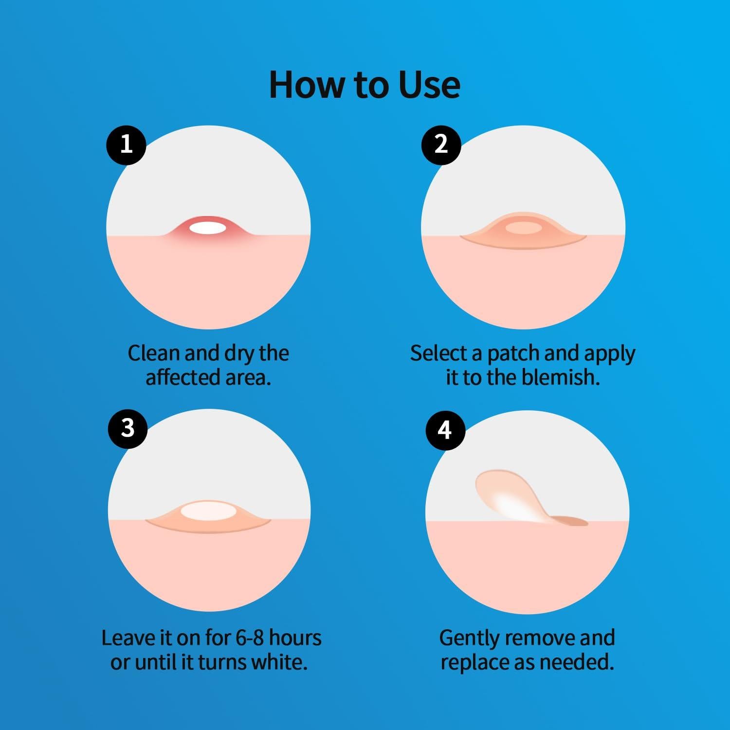 Parches para Granos Hidrocoloides GOESTRIC 216 Unidades