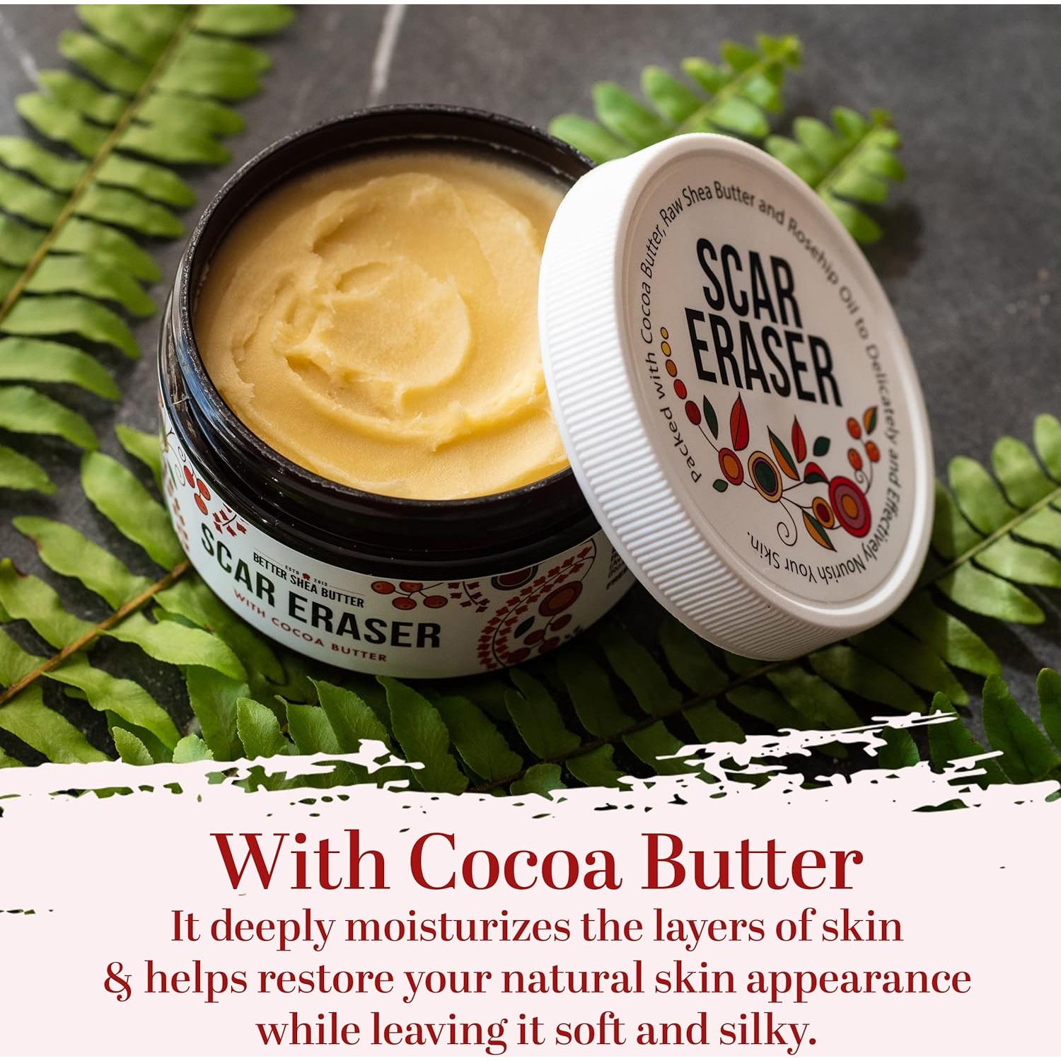 Bálsamo Natural para Cicatrices y Estrías Mejor Manteca 113g