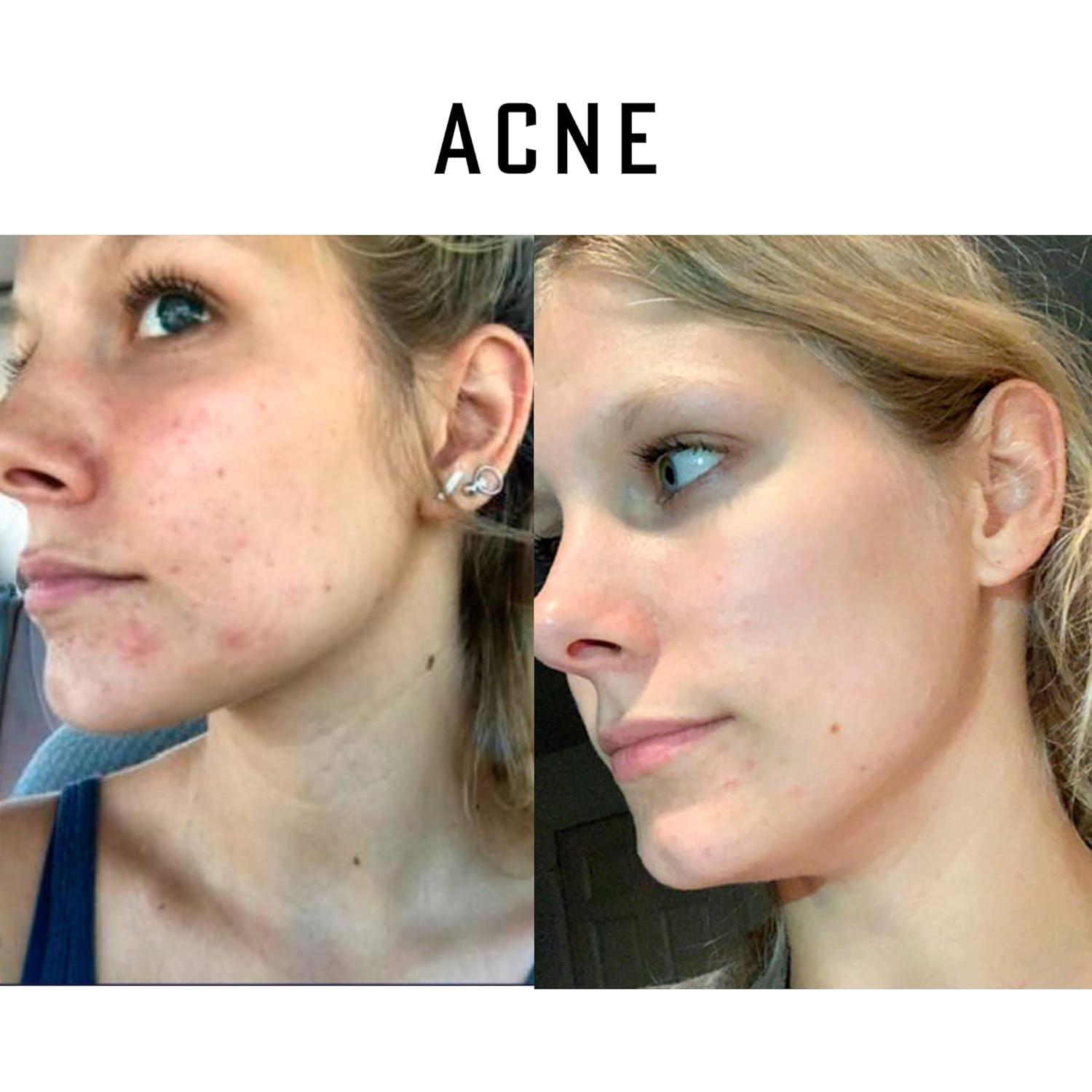 Aceite de Oliva Ozonizado Orgánico Simply O3 59 ml Antienvejecimiento