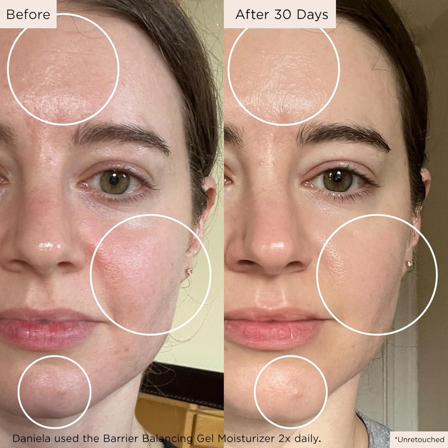 Gel Hidratante Equilibrante Medature 50ml Piel Mixta Grasa