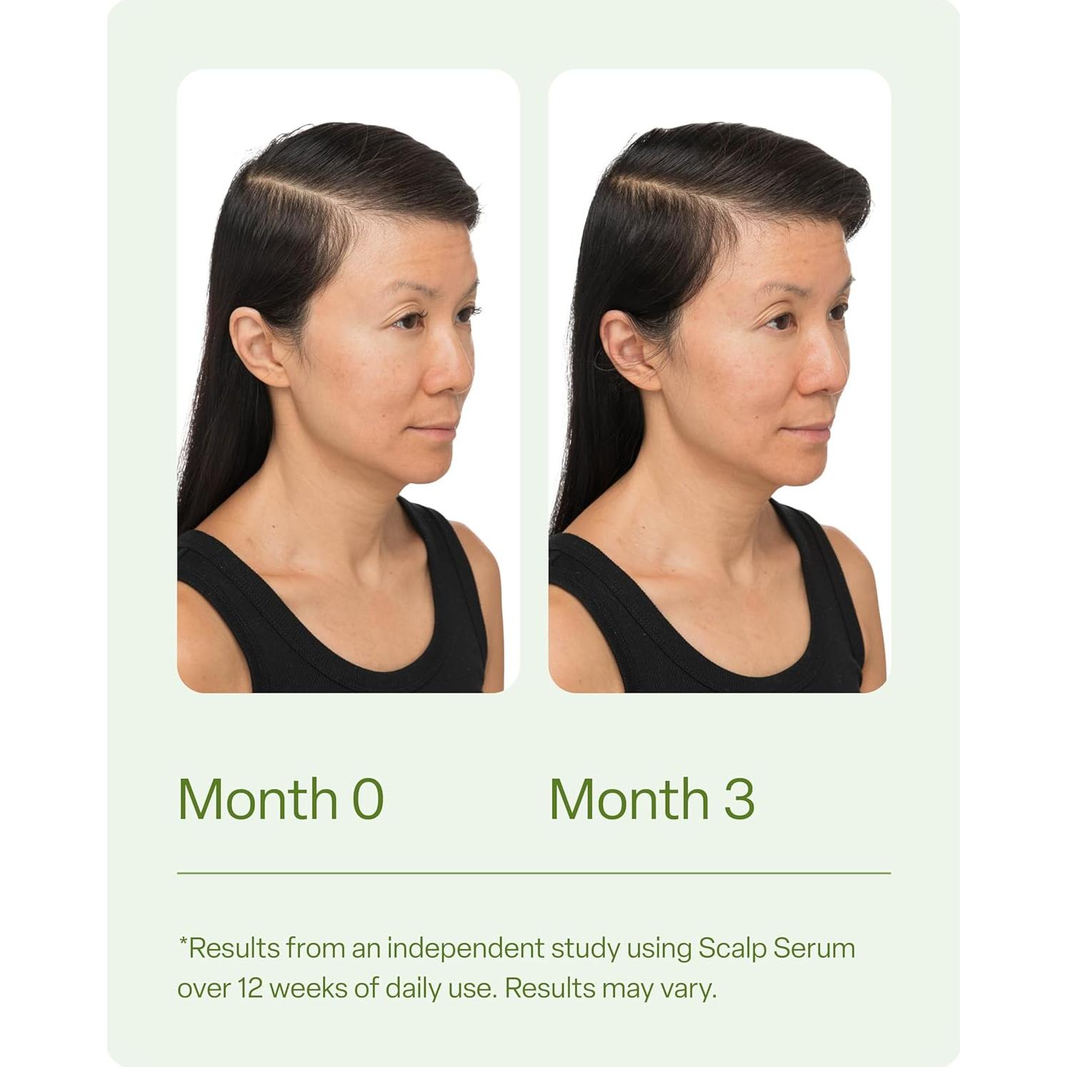 Suero para Cuero Cabelludo Divi 30 ml - Nutritivo y Voluminizador