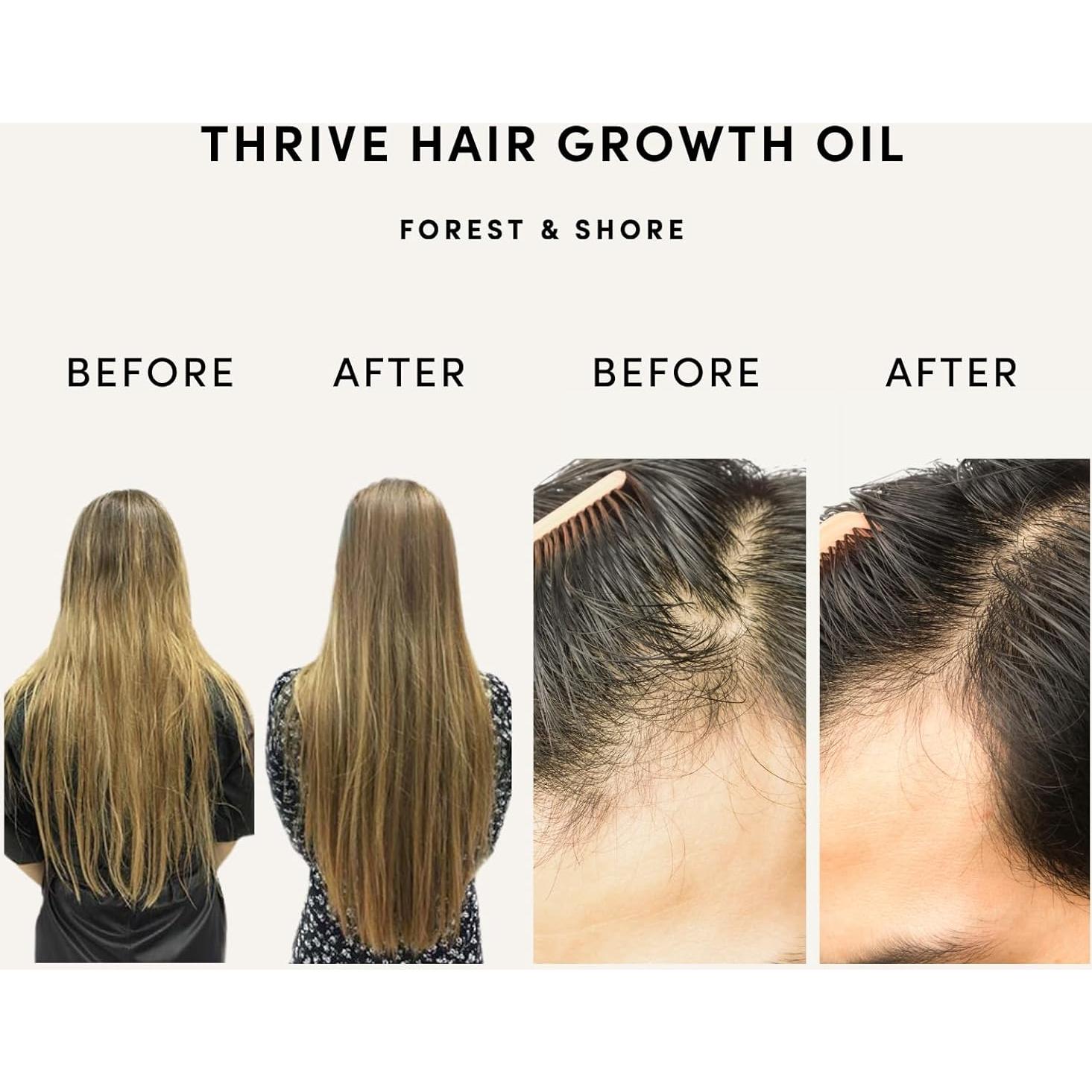 Aceite para Crecimiento del Cabello Forest & Shore 100ml