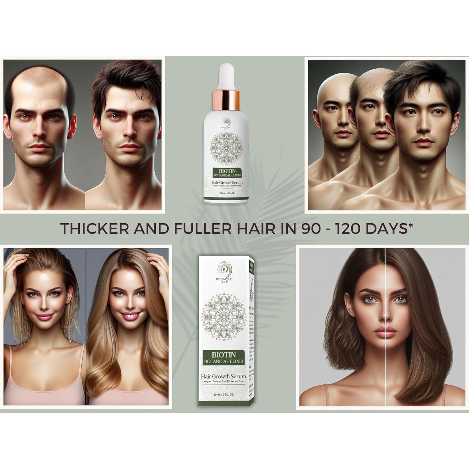 Suero Crecimiento Cabello Botanique Bliss 29.57 ml - 5% Minoxidil