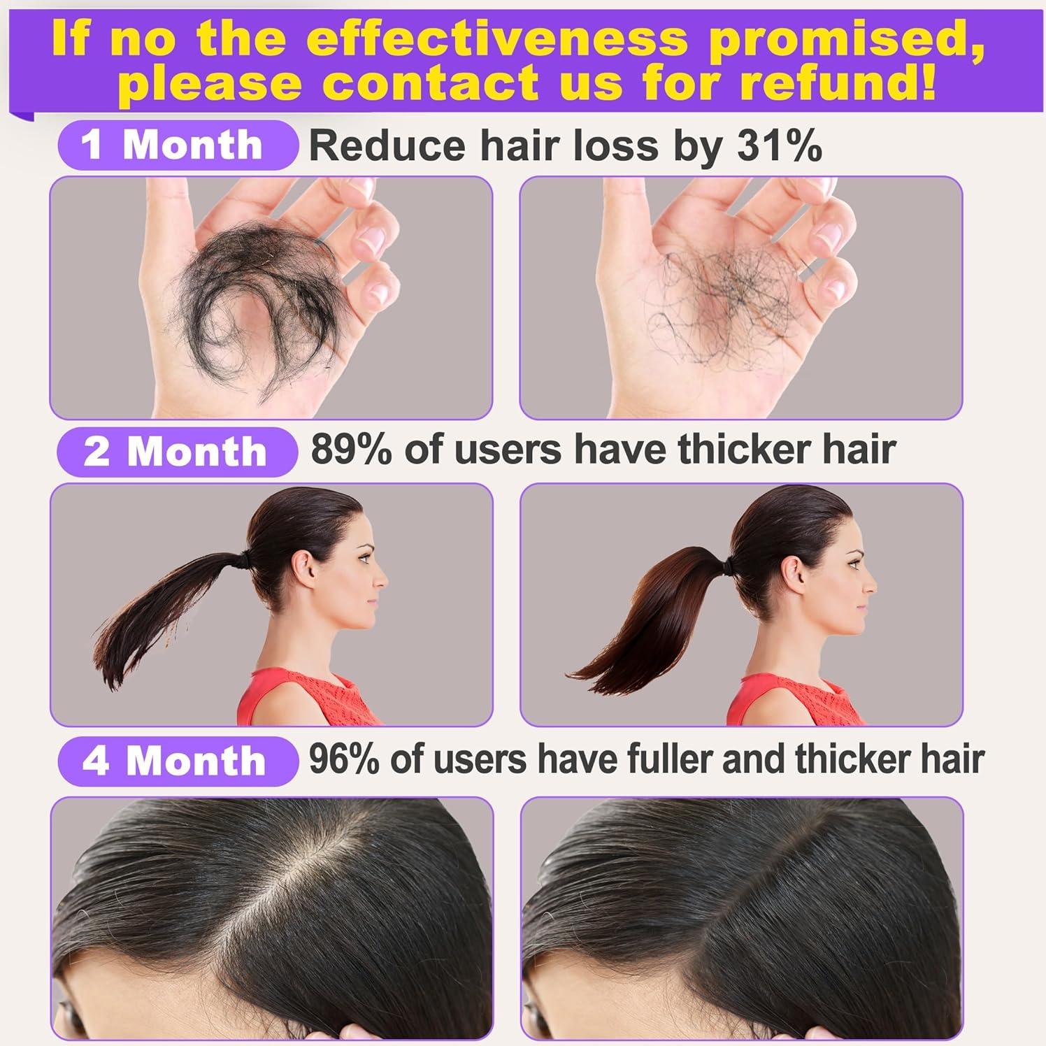 Suero de Crecimiento del Cabello Goldworld con Aceite de Romero y Masajador - 2 Paquetes