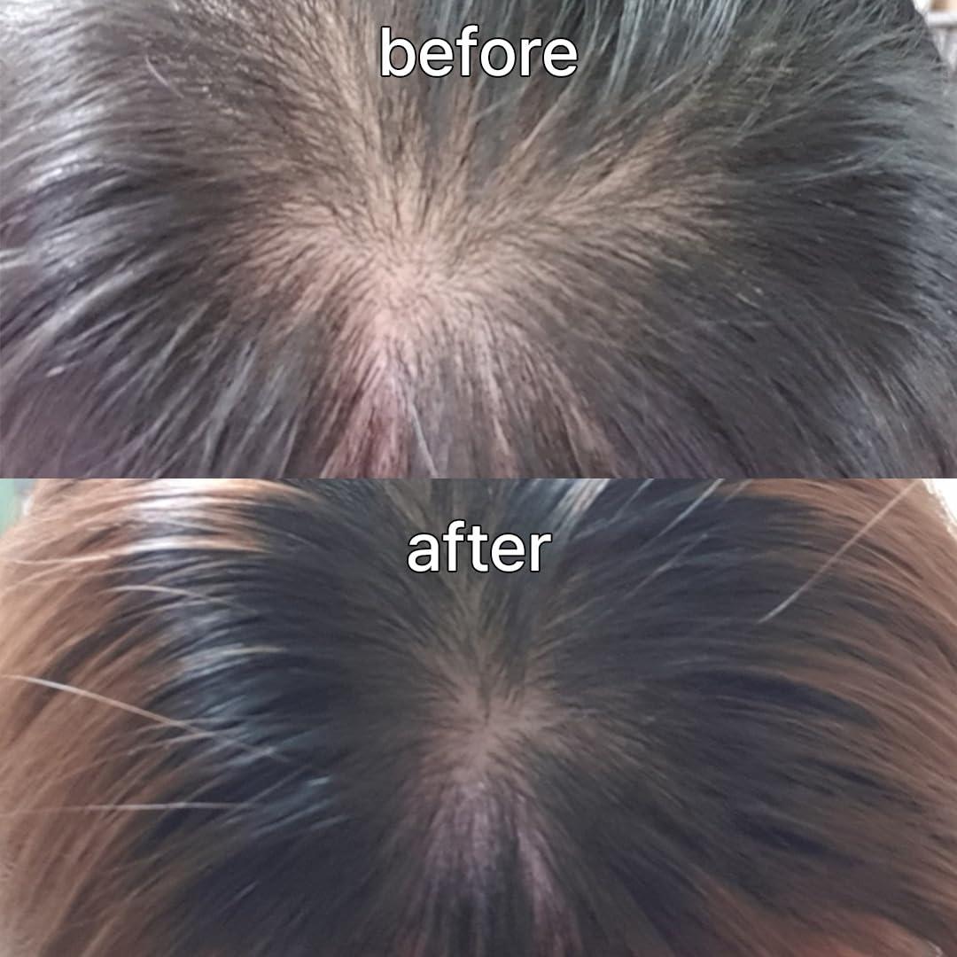 Suero Vivelab para Cuero Cabelludo y Cabello Delgado 15ml