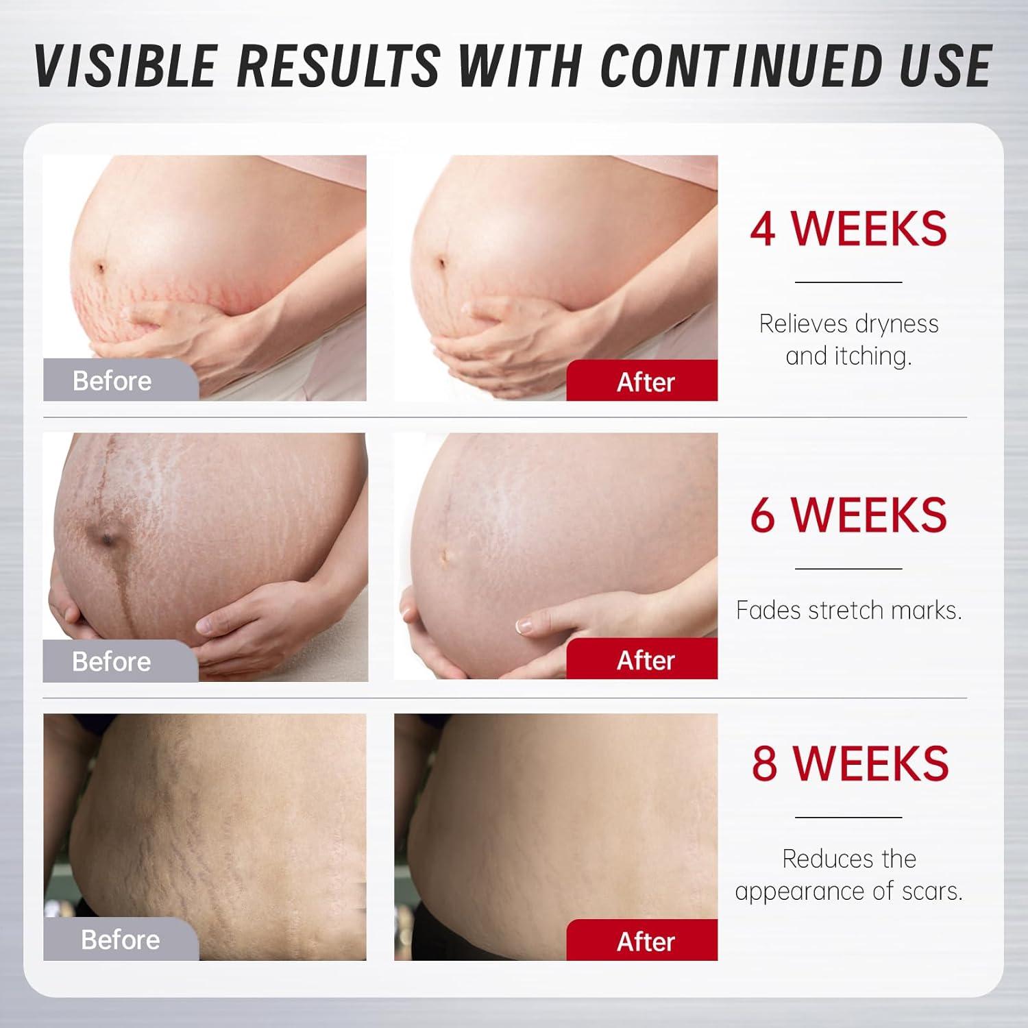 Aceite Corporal VGO 120 ml con Vitamina E Hidratante para Piel Seca