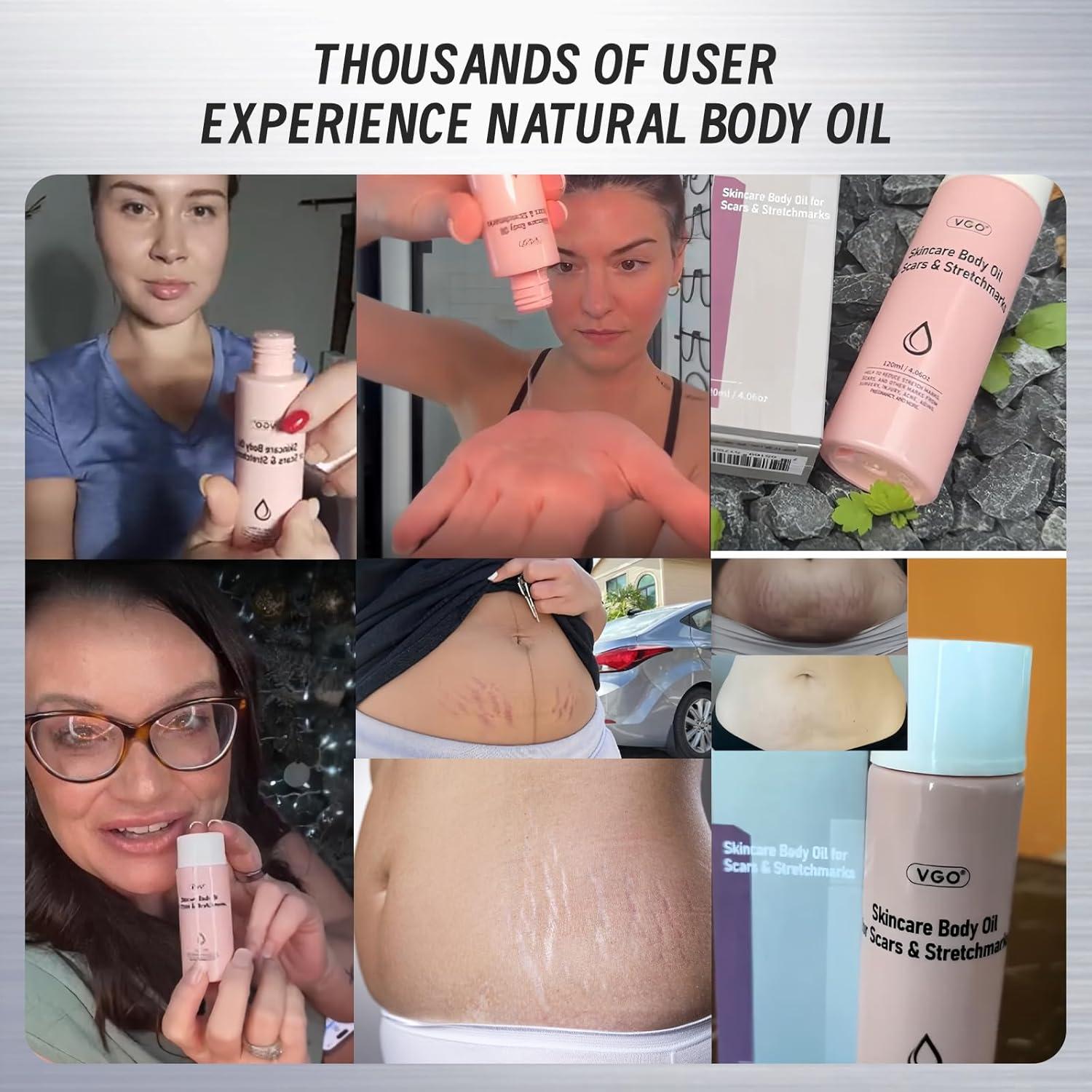 Aceite Corporal VGO 120 ml con Vitamina E Hidratante para Piel Seca