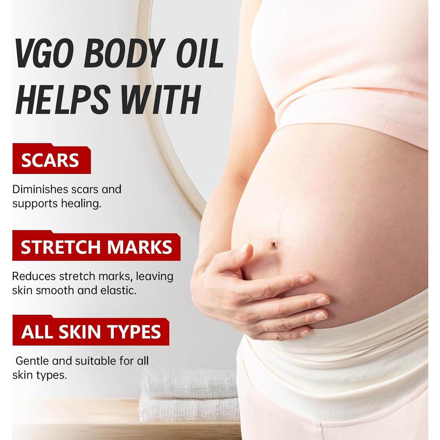 Aceite Corporal VGO 120 ml con Vitamina E Hidratante para Piel Seca