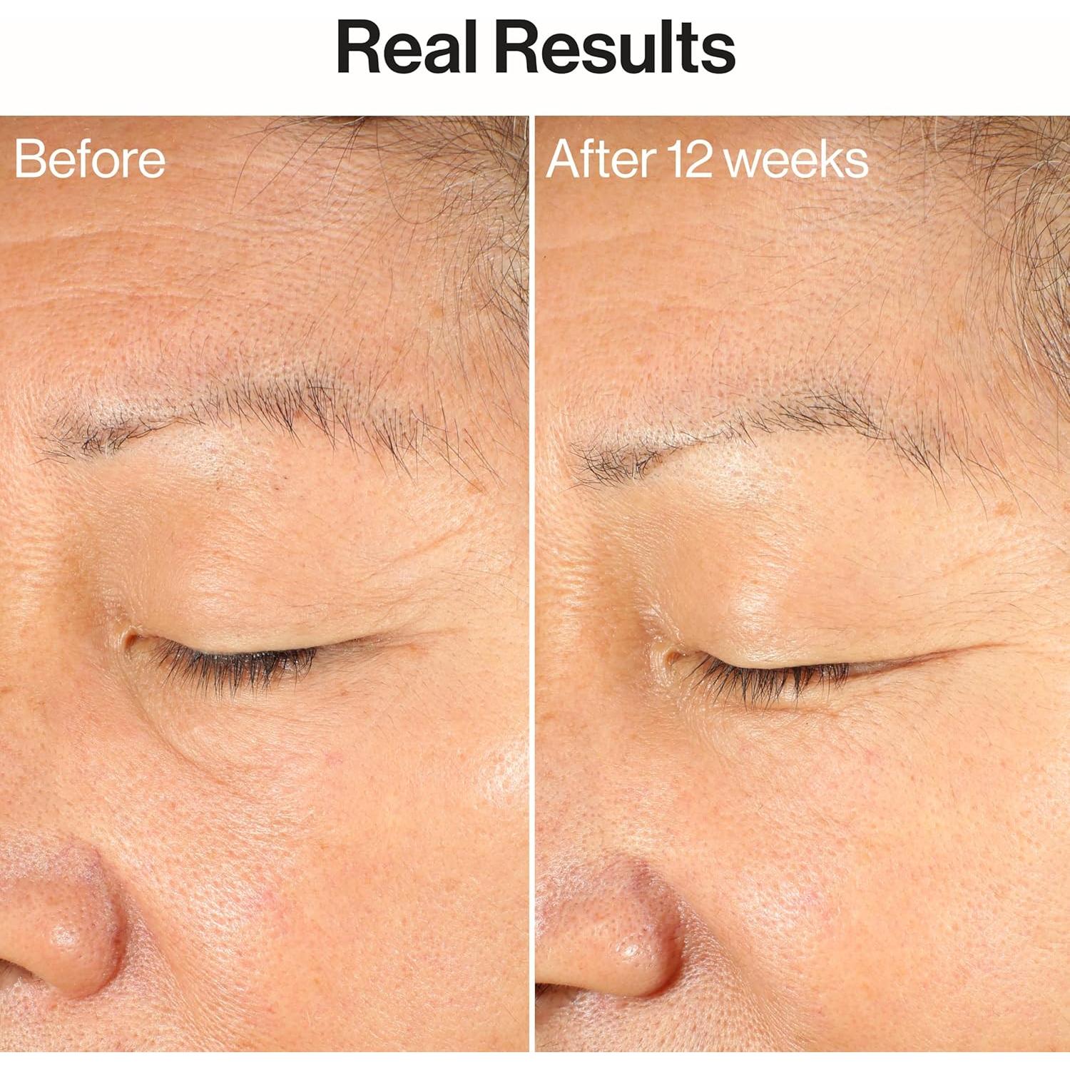 Paquete Toallitas Desmaquillantes Honest Beauty + Suero Ageless 30ml