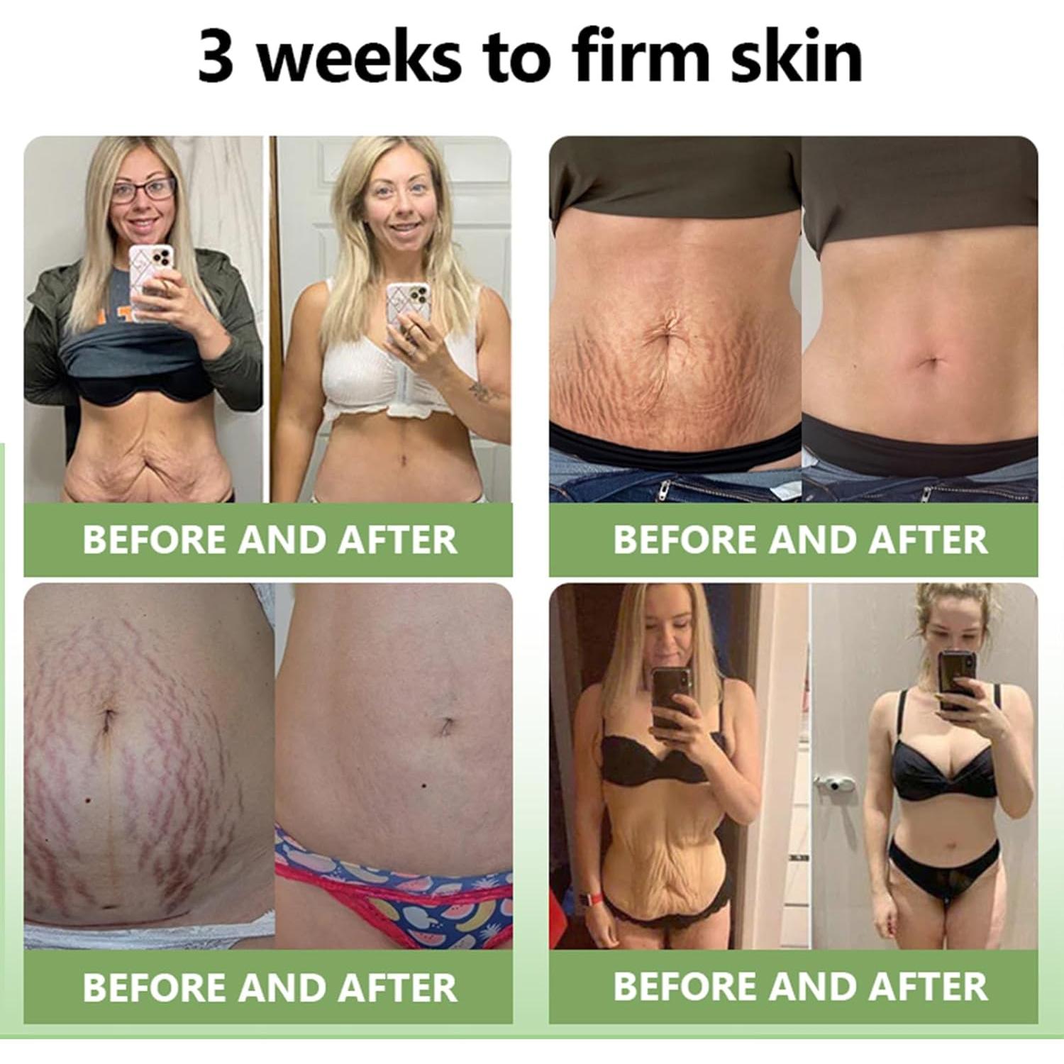 Crema Reafirmante de Colágeno Lujo STDEI - Hidratante Corporal 2 Botellas