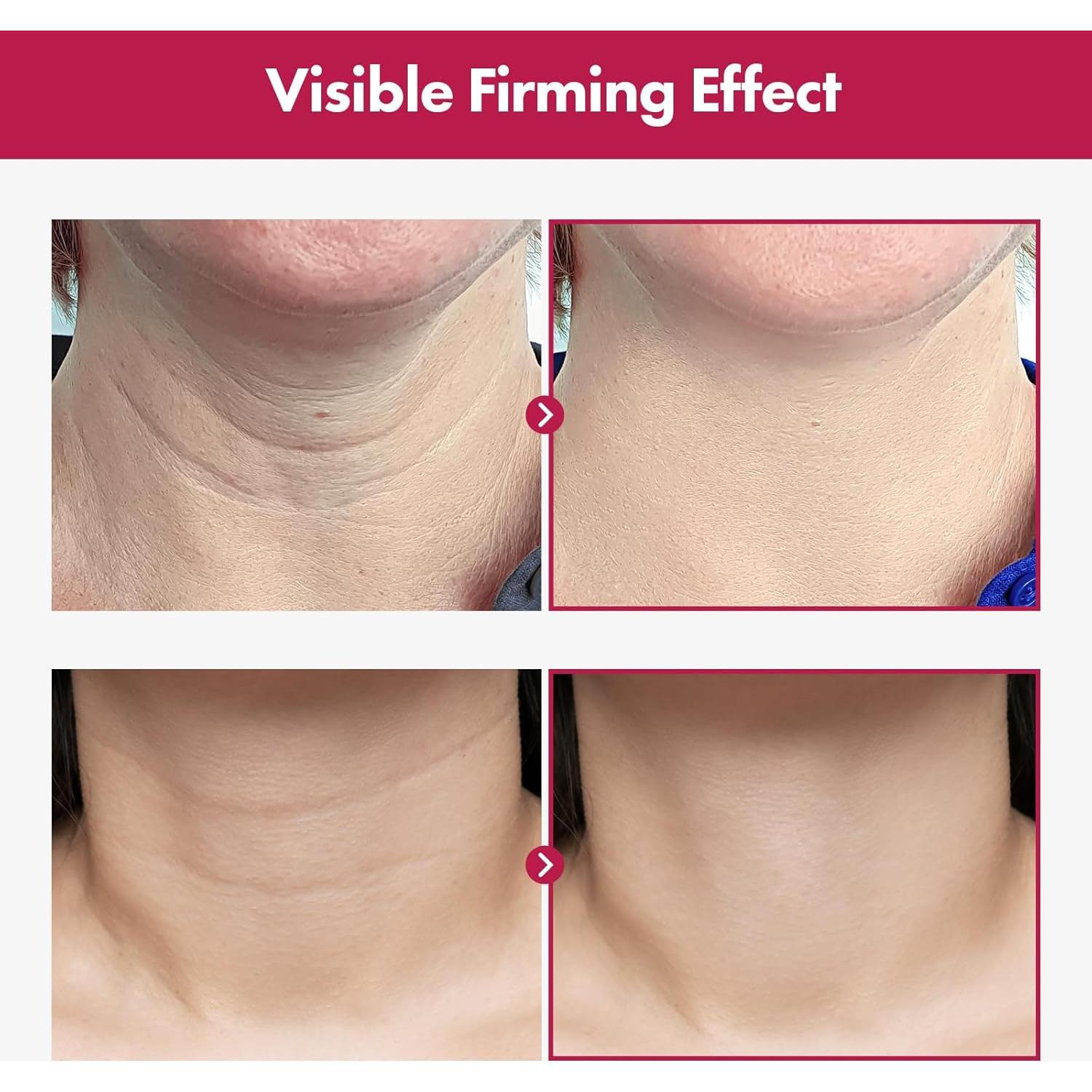 Crema Reafirmante para Cuello Collagen Necktox MANTONG 50ml