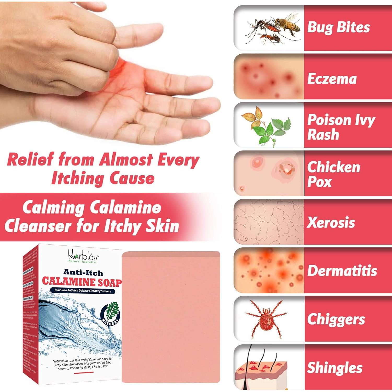 Jabón Natural Calmante Herblov 117g para Alivio de Picazón