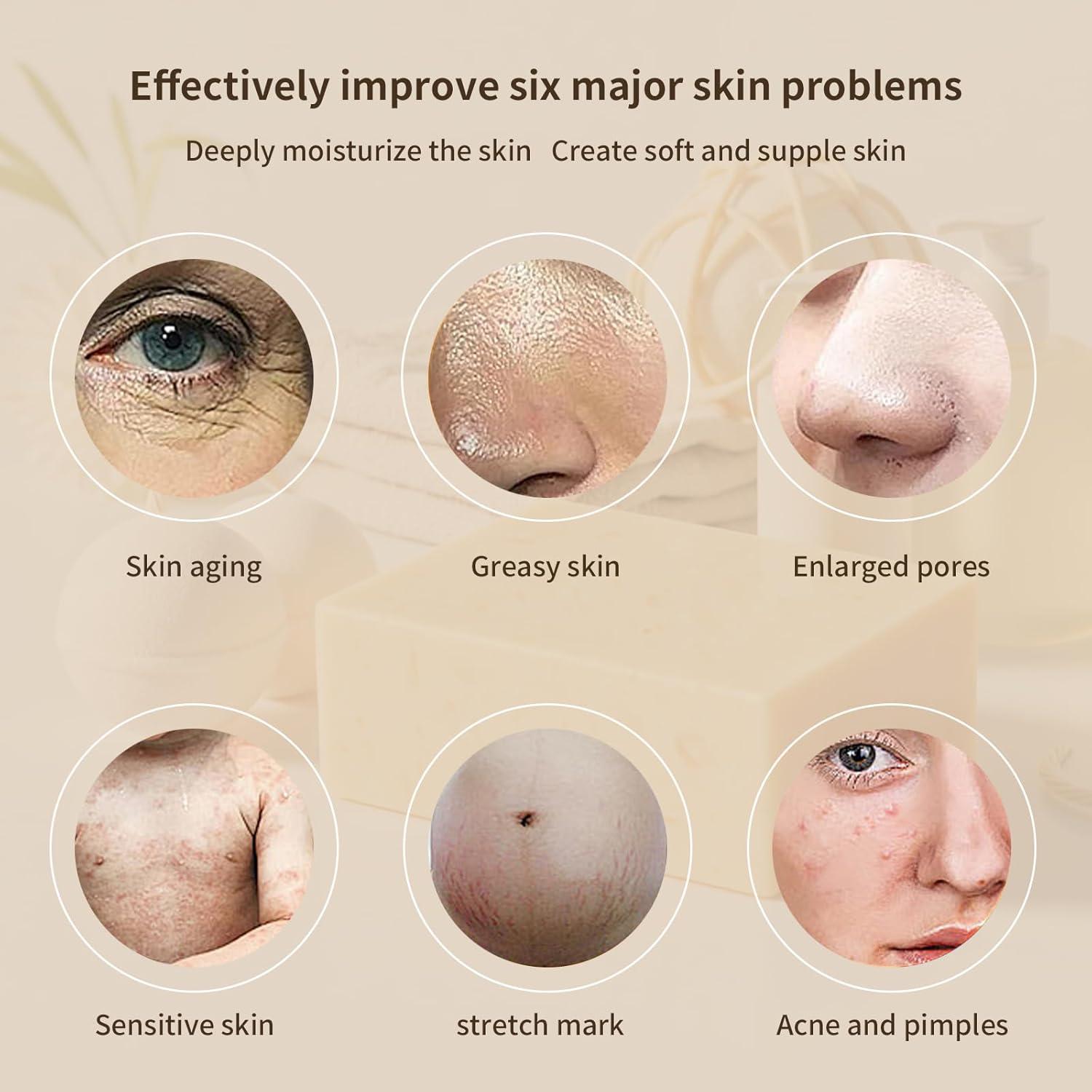 Jabón de Cúrcuma Sophumson para Cara y Cuerpo - 6 Piezas 0.59kg