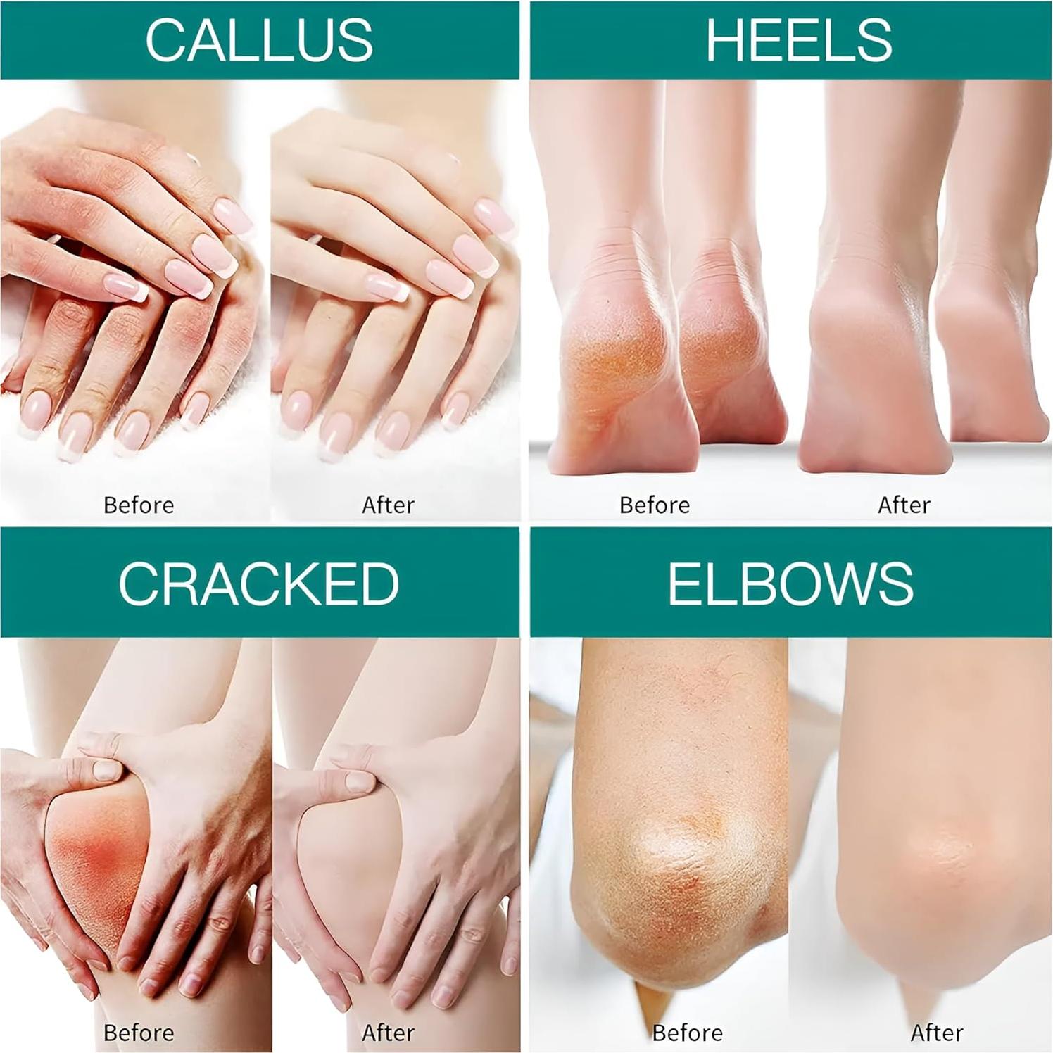 Crema para Manos y Pies Jensy 40% Urea 73.2 ml Hidratante