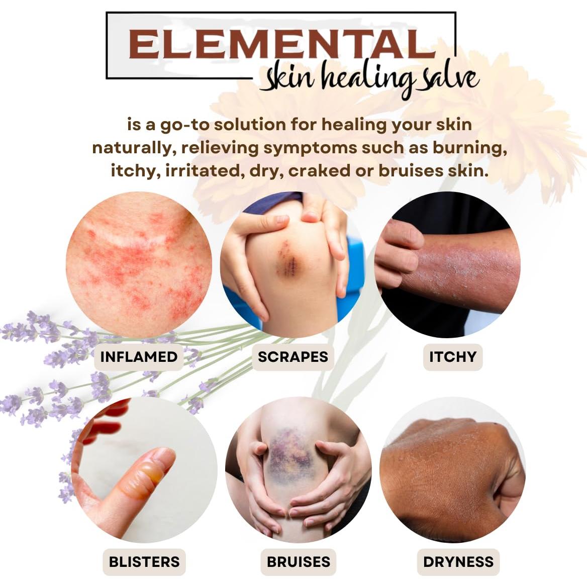 Pomada Natural para Piel Seca Tienda de Bienestar 56.7 g