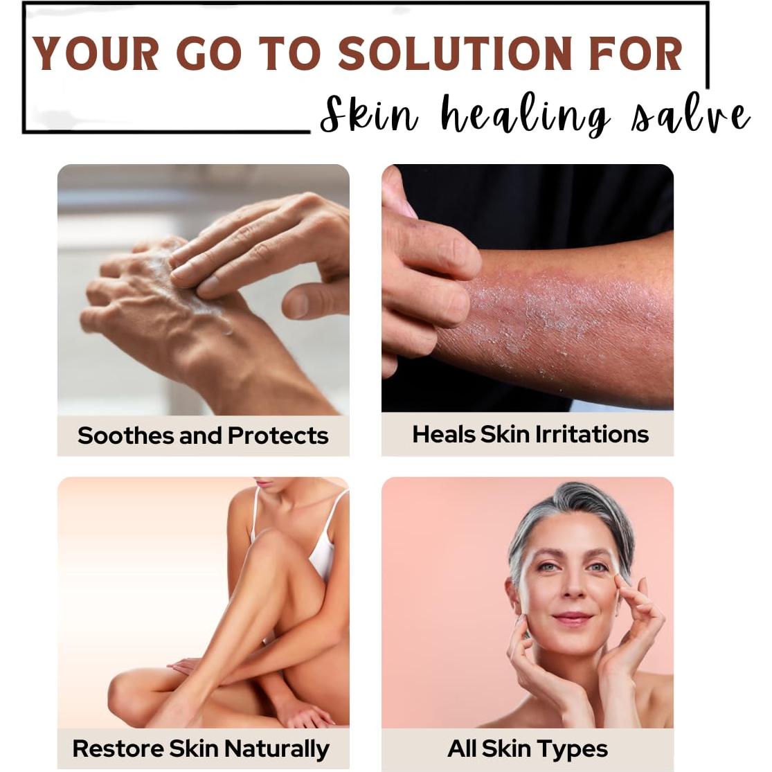 Pomada Natural para Piel Seca Tienda de Bienestar 56.7 g