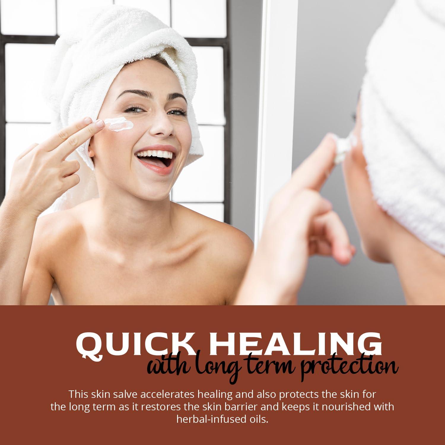 Pomada Natural para Piel Seca Tienda de Bienestar 56.7 g