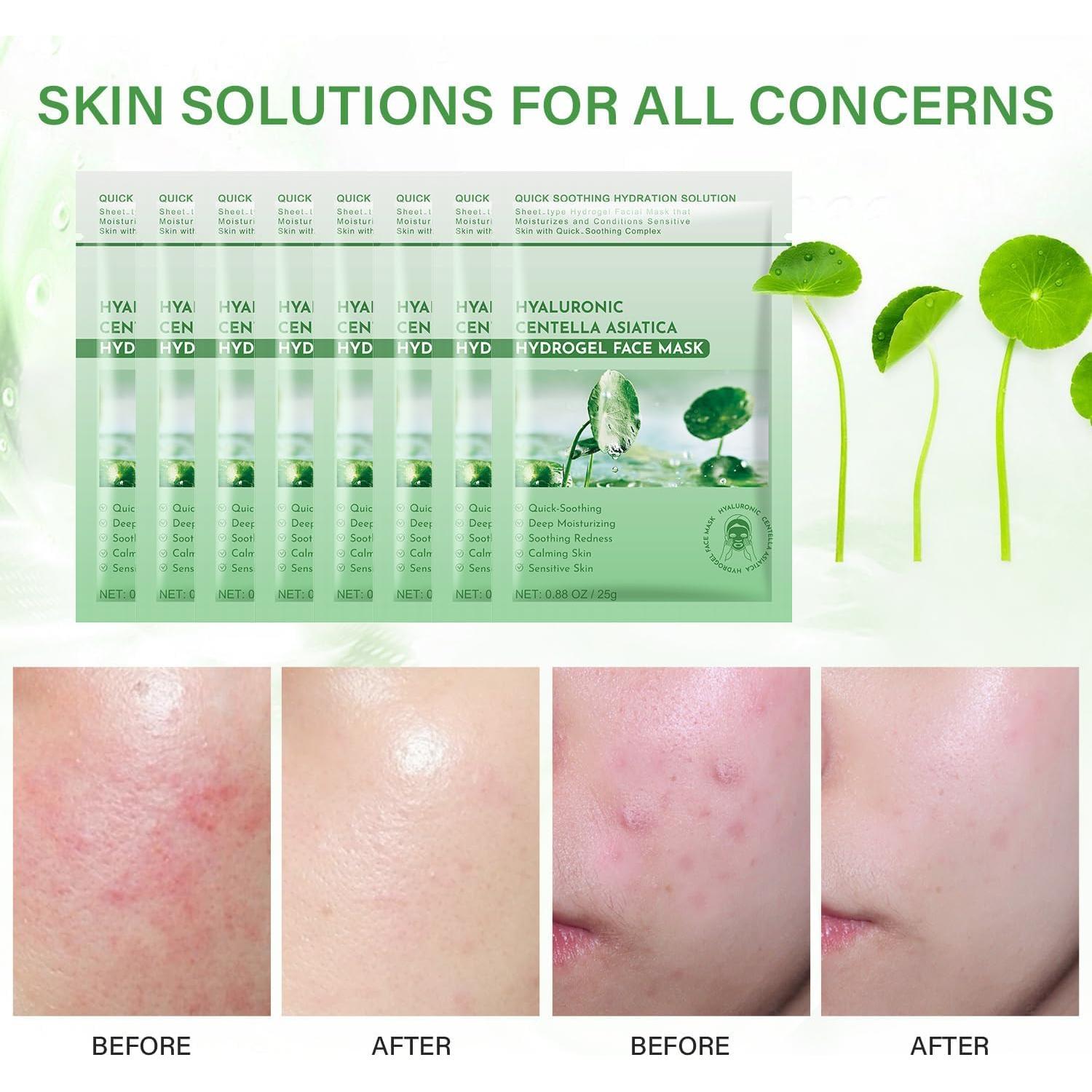 Mascarilla Facial Calmante Centella Asiática 10 Paquetes