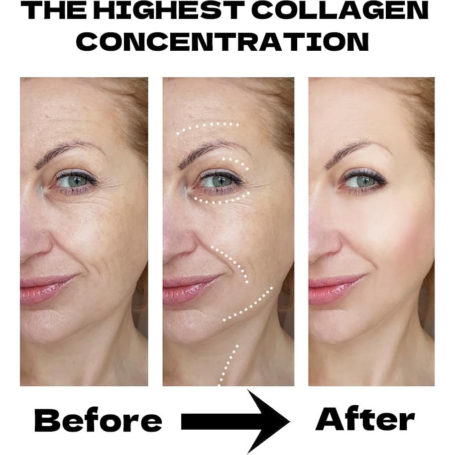 Mascarilla Facial de Colágeno Hidratante MKBLNP - 6 Piezas