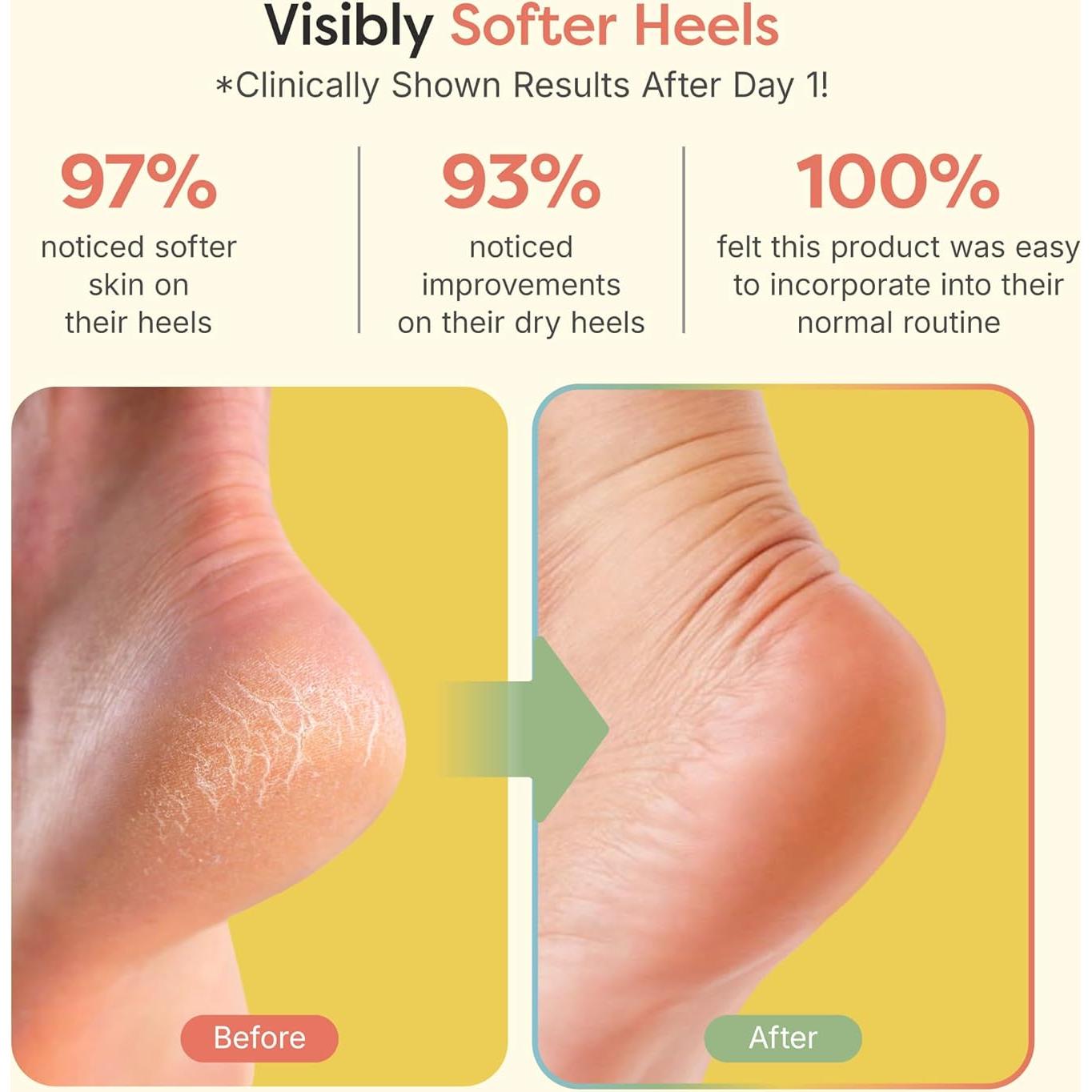 Calcetines Hidratantes ZenToes para Talones Agrietados - Regular