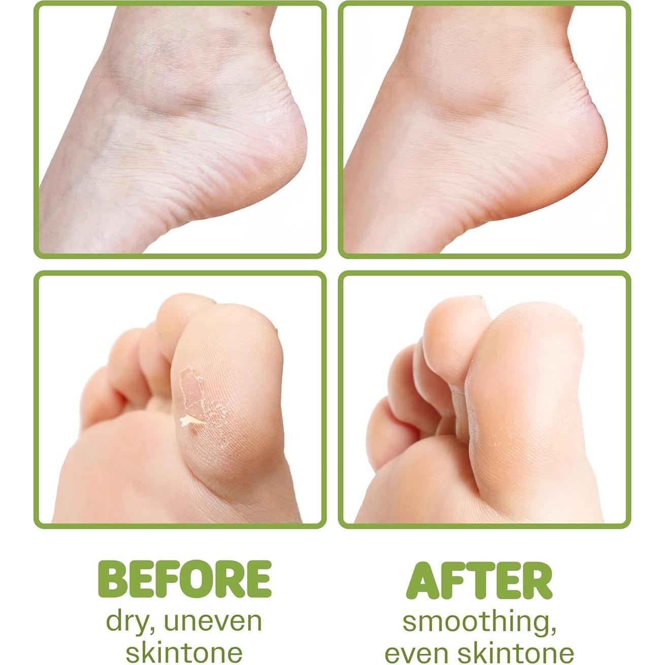 Mascarilla Hidratante para Pies Secos ONSOI 6PK Karité y Oliva