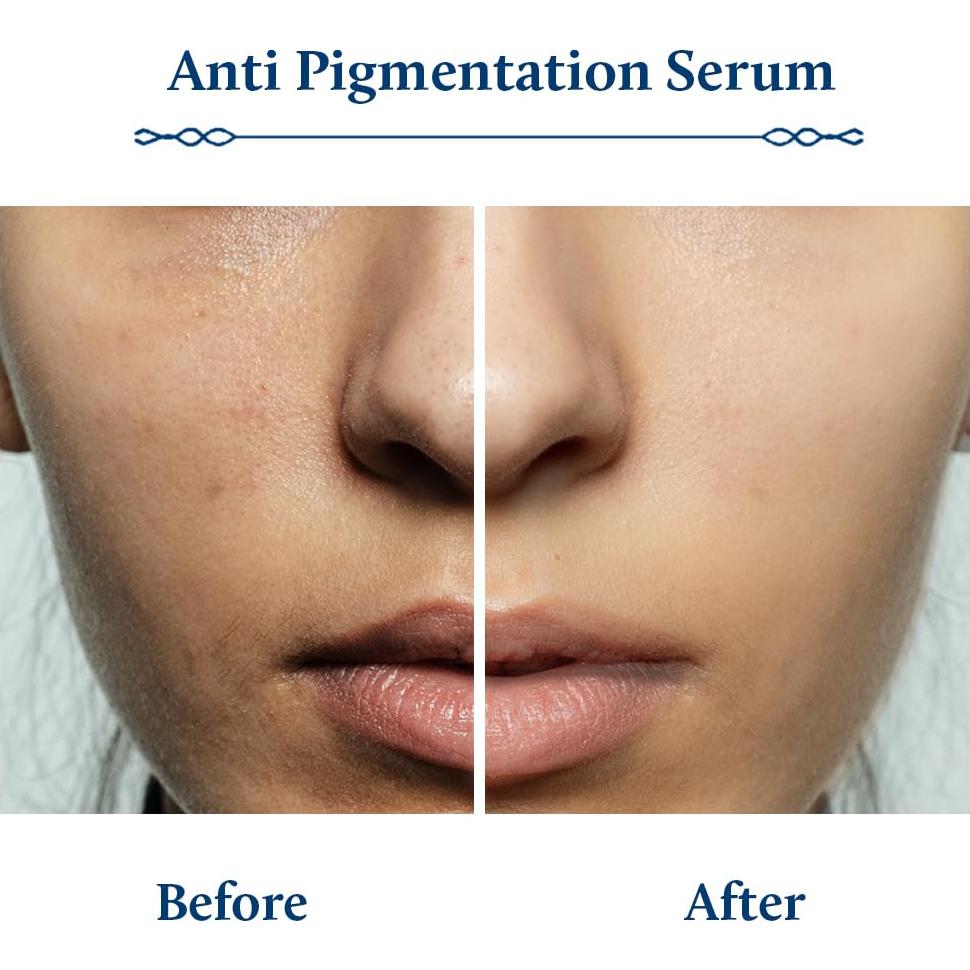 Suero Facial Blue Nectar de Ácido Kojico 30 ml - Agua de Arroz