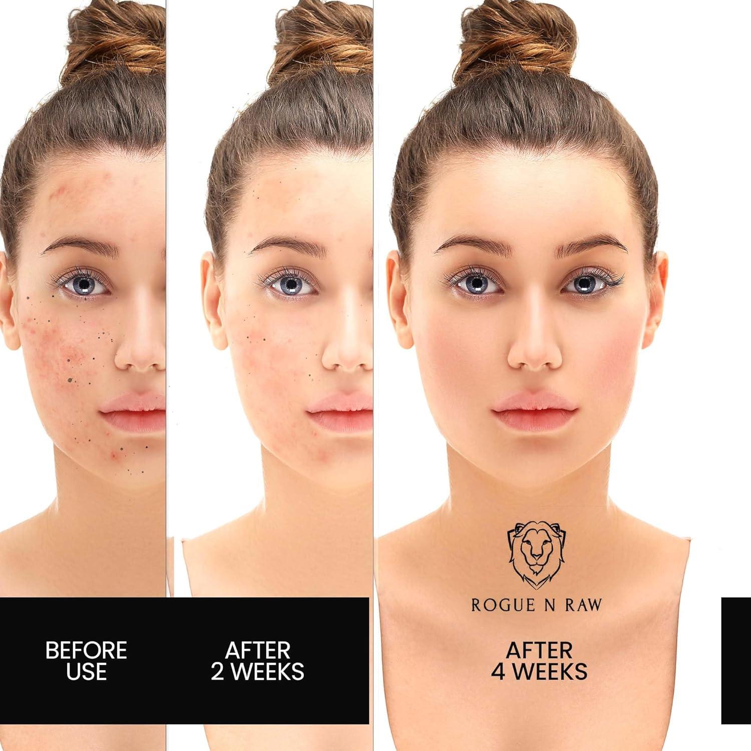 Jabón de Ácido Kójico Rogue N Raw con Cúrcuma y Colágeno - 2x100g