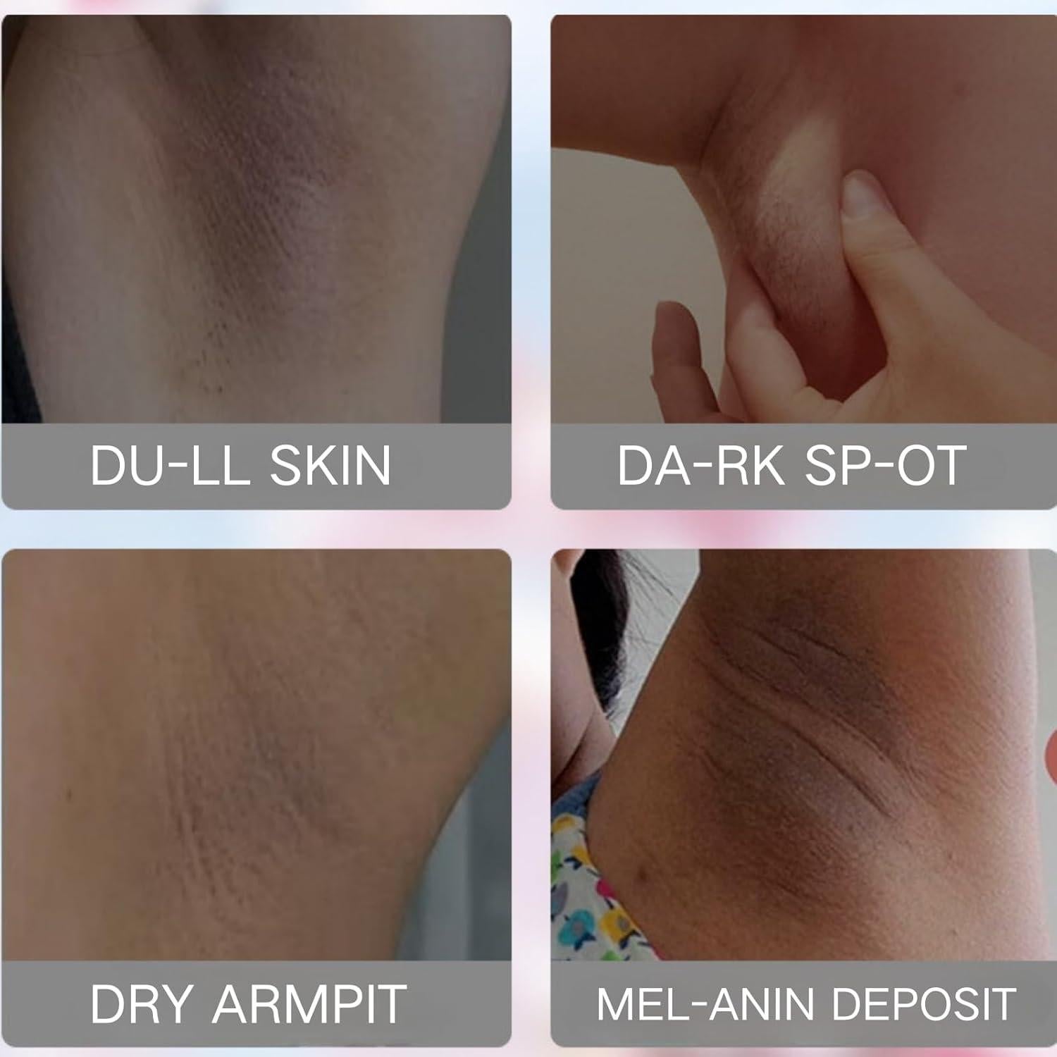 Crema Blanqueadora Evolvique para Mujeres - Hidratante y Aclaradora para Axilas y Cuerpo