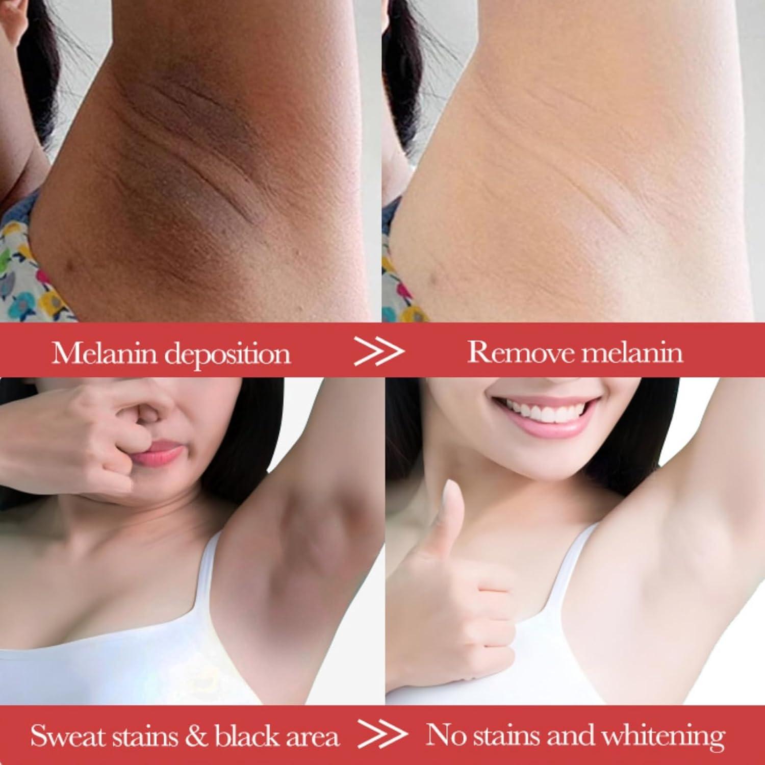 Crema Blanqueadora Evolvique para Mujeres - Hidratante y Aclaradora para Axilas y Cuerpo