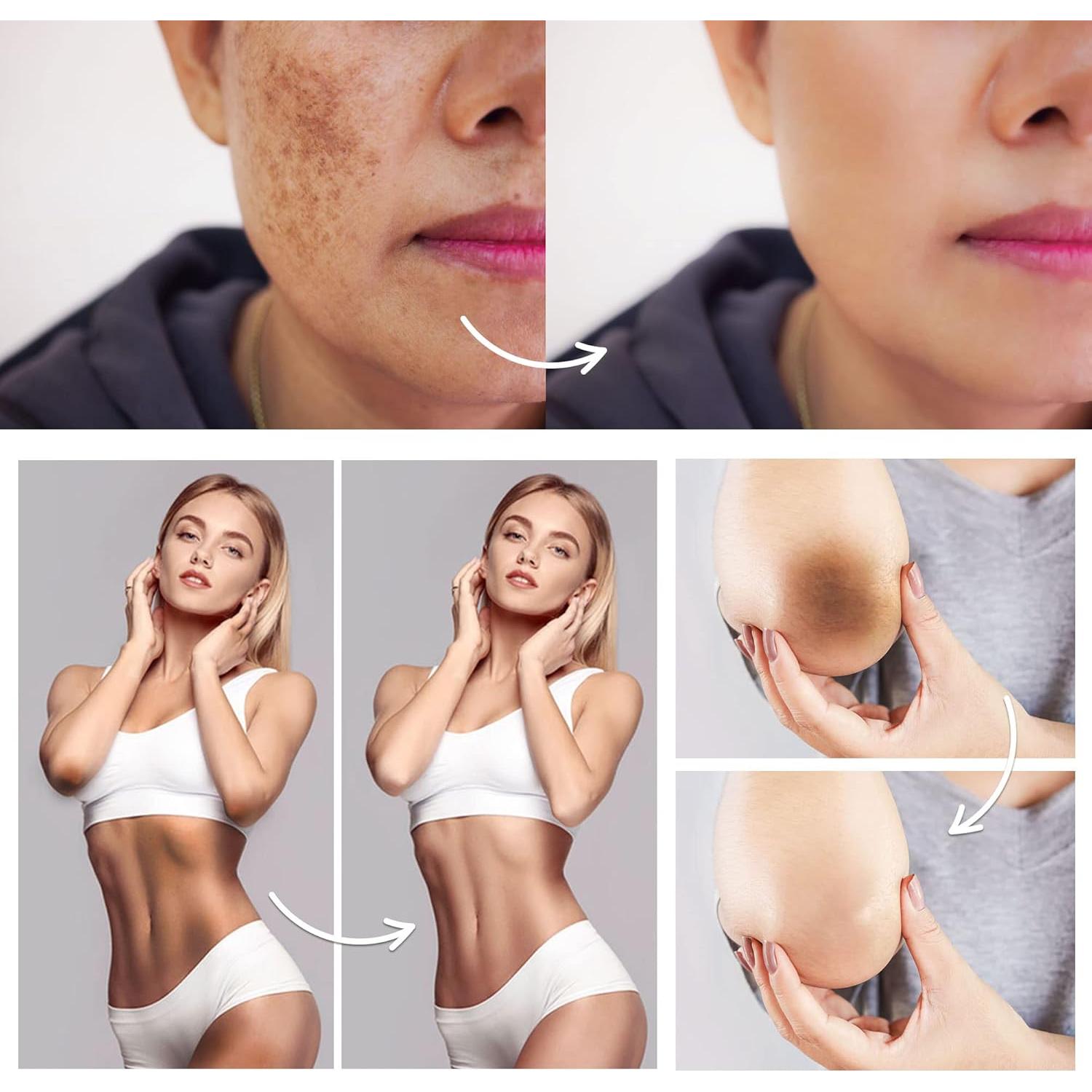 Crema Correctora de Manchas Famirosa - Piel Íntima y Axilas