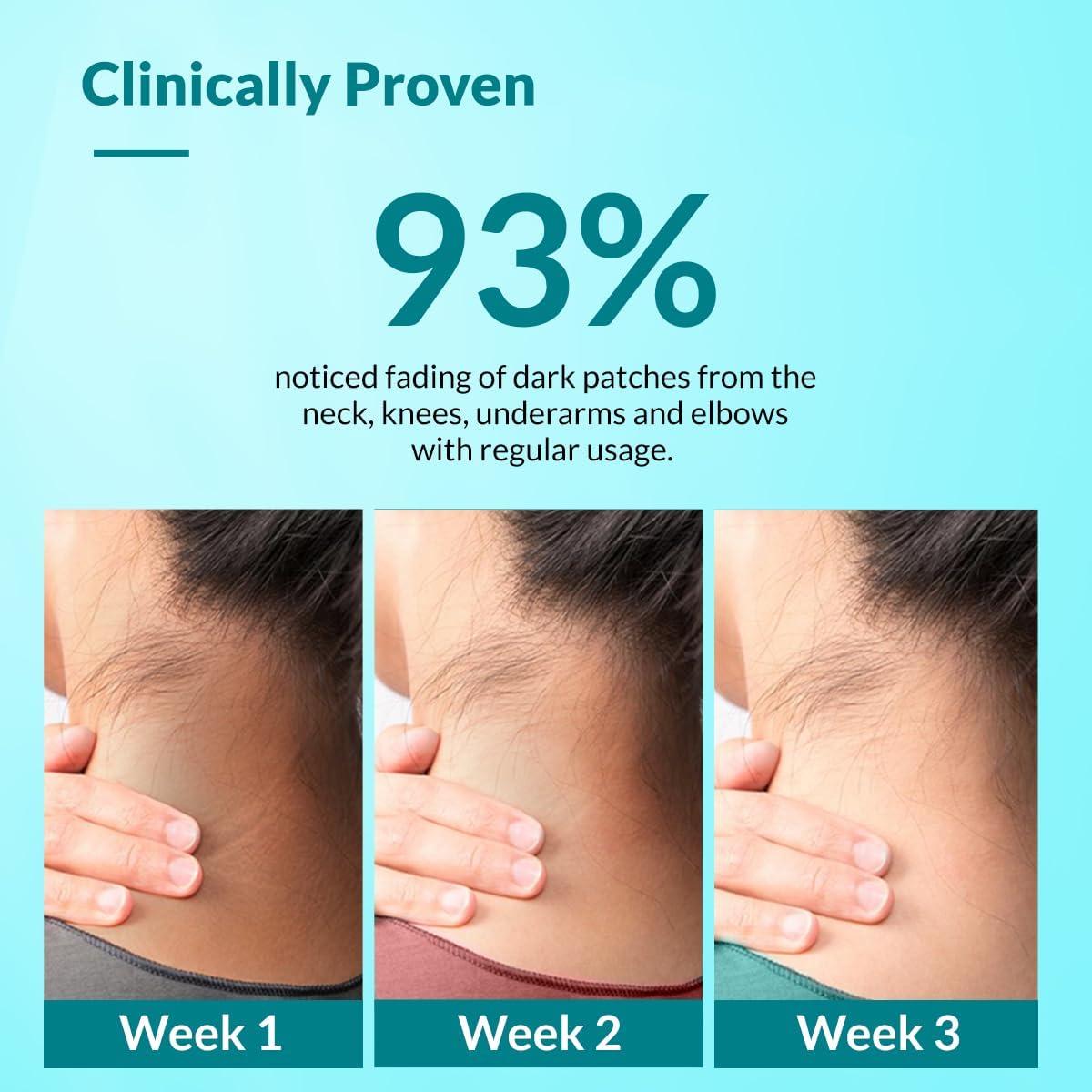 Crema Nigrifix Fixderma 100 ml para Acantosis Nigricans