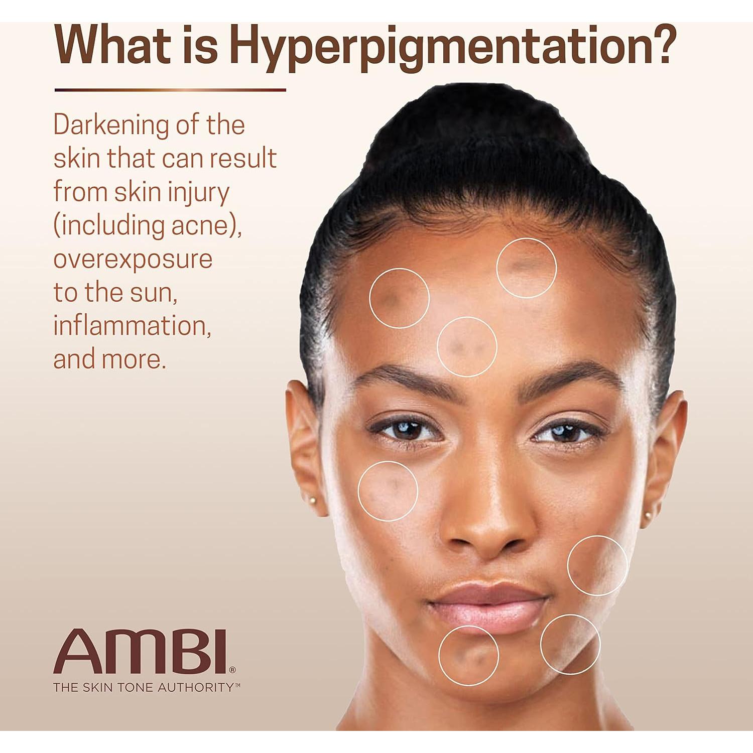 Crema Desvanecedora Ambi Even & Clear 29.57 ml - Hiperpigmentación