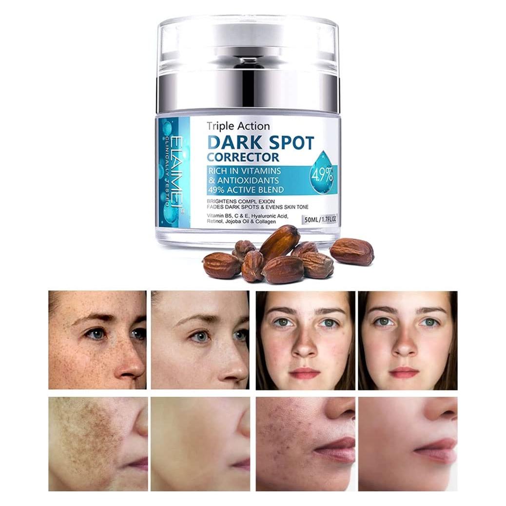 Removedor de Manchas Oscuras SWETIYOU 160g - Unifica Tono Piel