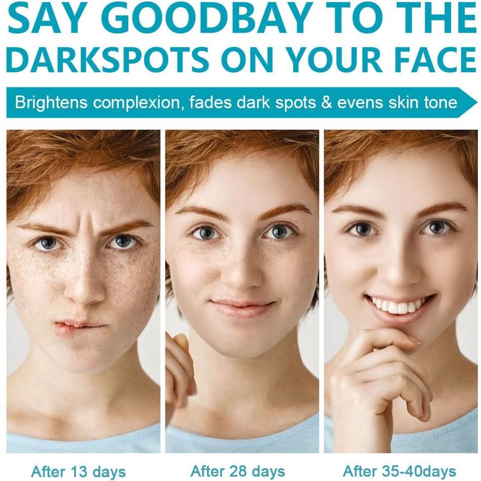 Removedor de Manchas Oscuras SWETIYOU 160g - Unifica Tono Piel